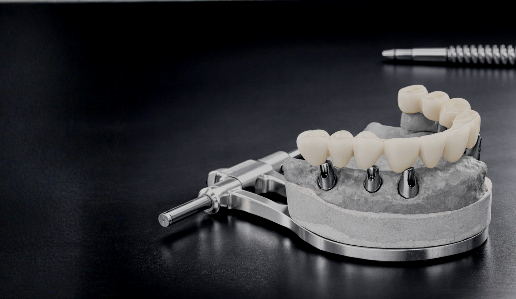 Sepember 27, 2026 - Implant Forces, TMJ Consequences