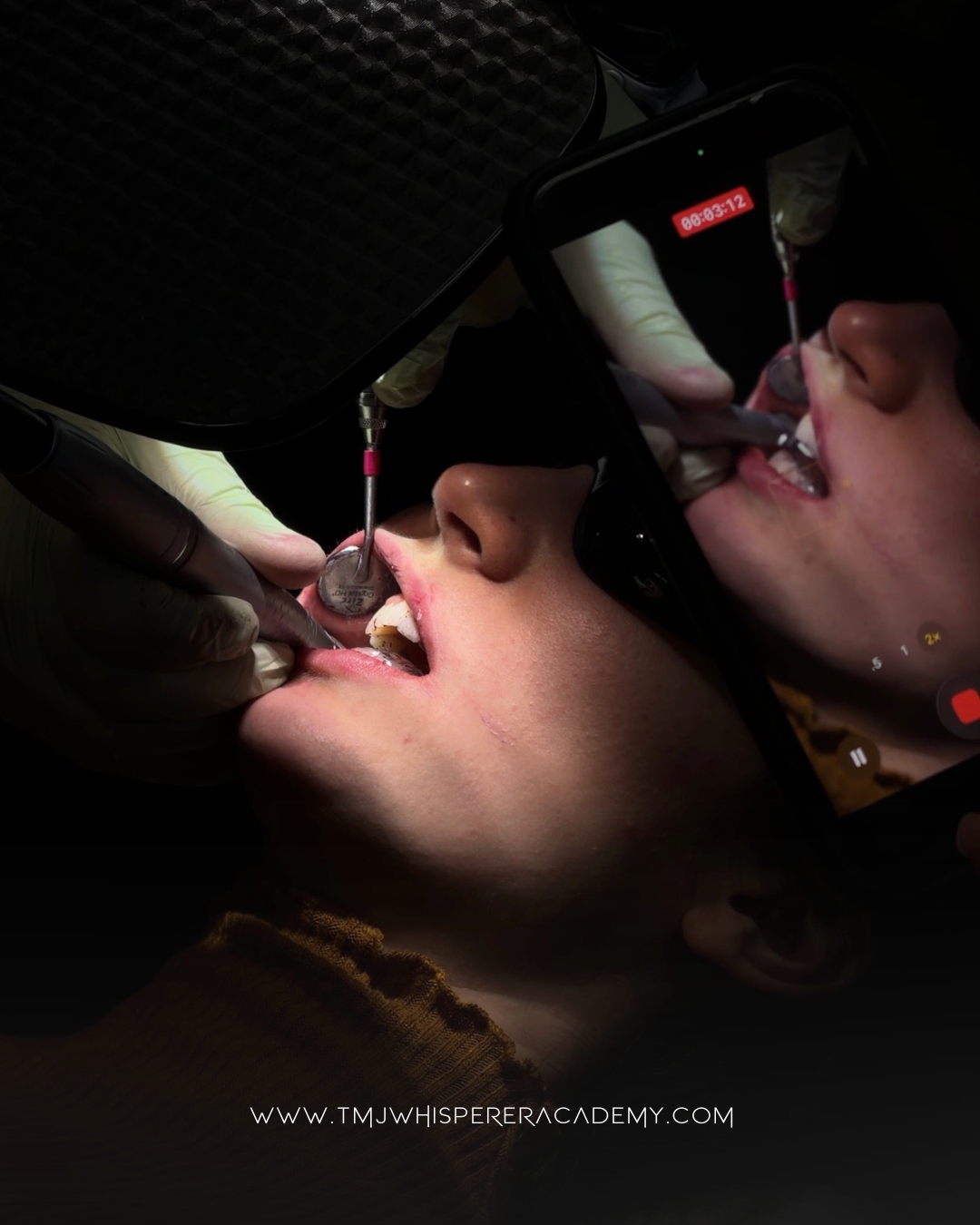 BiteAlign™ Orthotic Design and Adjustment