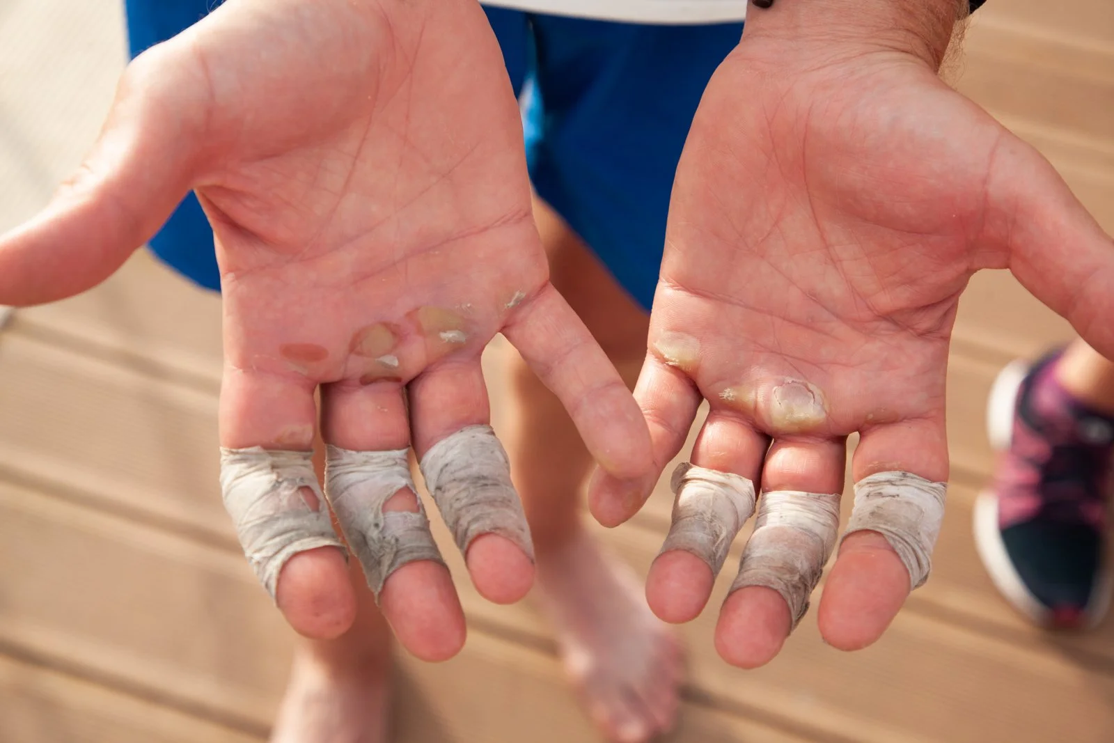 Leo's hands after Mediterranean row