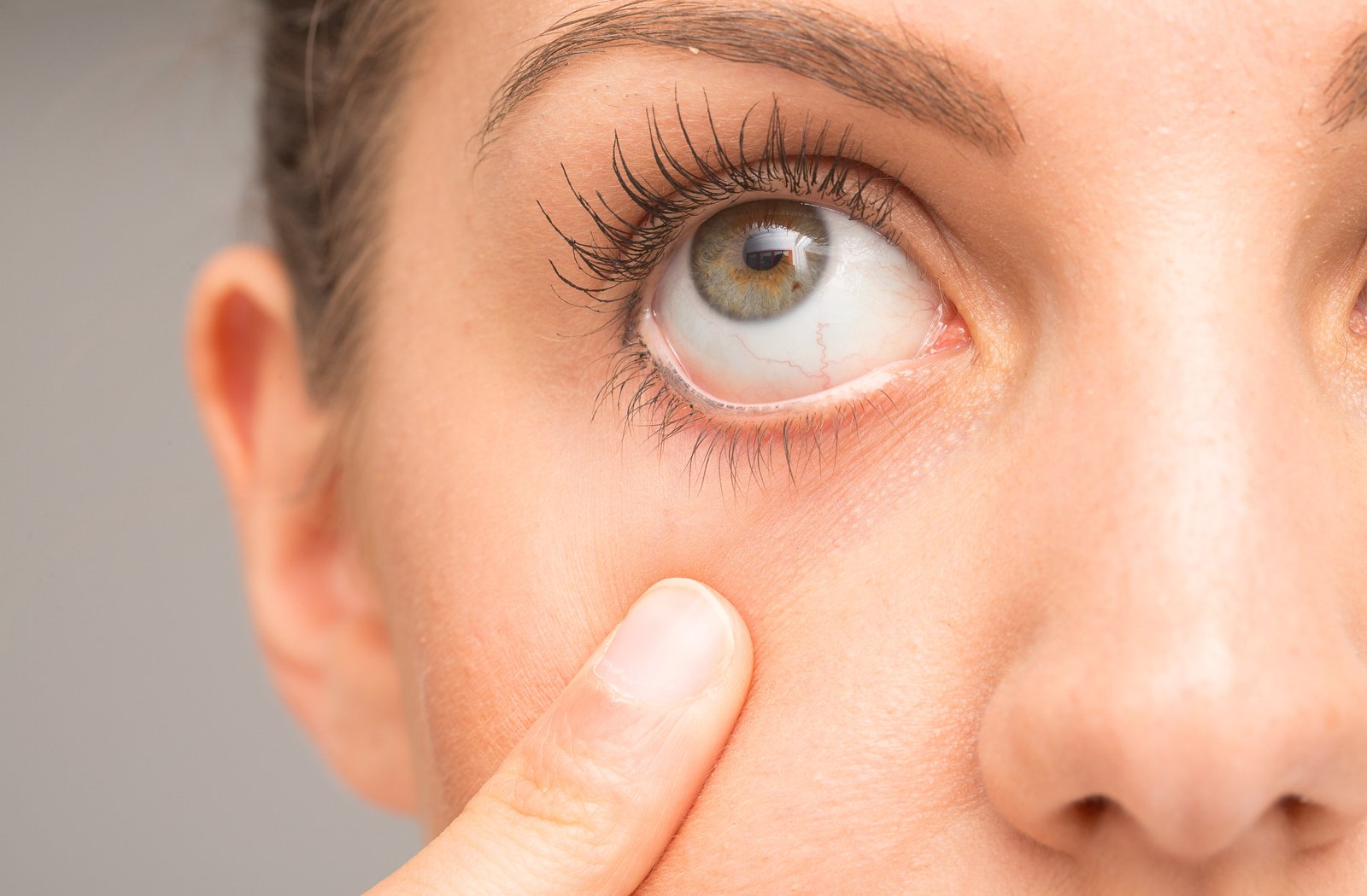 A Discovering Comfort: A Guide to Dry Eye Relief