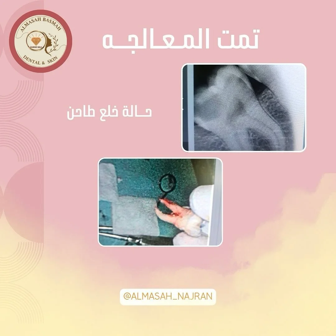 #من_زانت_اسنانه_زانت_حياته #هاشتاق #وزارة_الصحة 

.
#زينها_وعيش🌙💎🩷
.
&rlm;.#najran#trending #for#مدارس#دعم#مشاركه#ترند#اكسبلور#منصة_مدرسة #نور#السعودية #الخليج#الجنوب#نجران#نجران_الان #بنات_نجران #تجمع_بنات_الجنوب #تجمعات_بنات #تجمع_بنات_نجران #نج