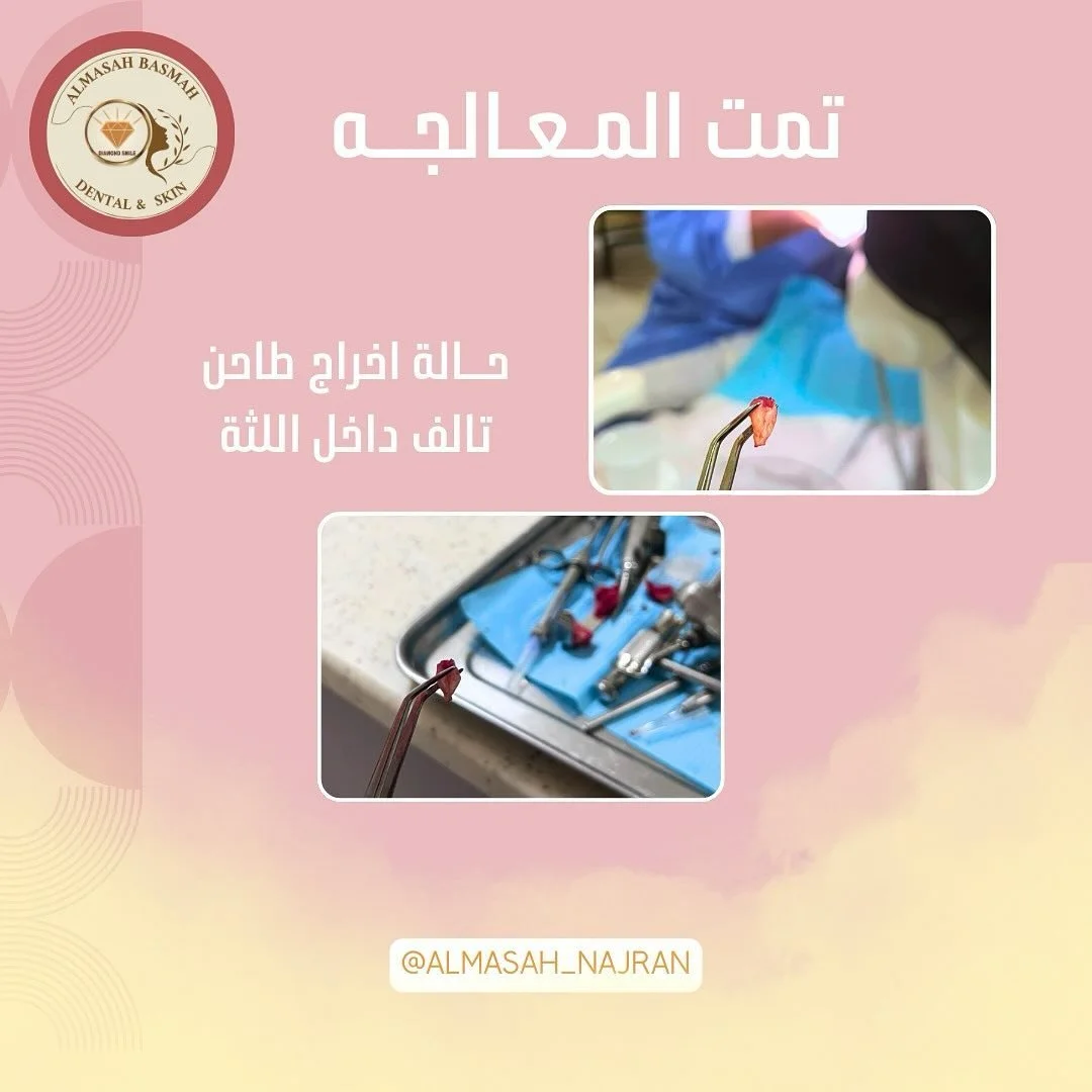 💎🩵✨
#من_زانت_اسنانه_زانت_حياته #هاشتاق #وزارة_الصحة 

.
#زينها_وعيش🌙💎🩷
.
&rlm;.#najran#trending #for#مدارس#دعم#مشاركه#ترند#اكسبلور#منصة_مدرسة #نور#السعودية #الخليج#الجنوب#نجران#نجران_الان #بنات_نجران #تجمع_بنات_الجنوب #تجمعات_بنات #تجمع_بنات_نجر