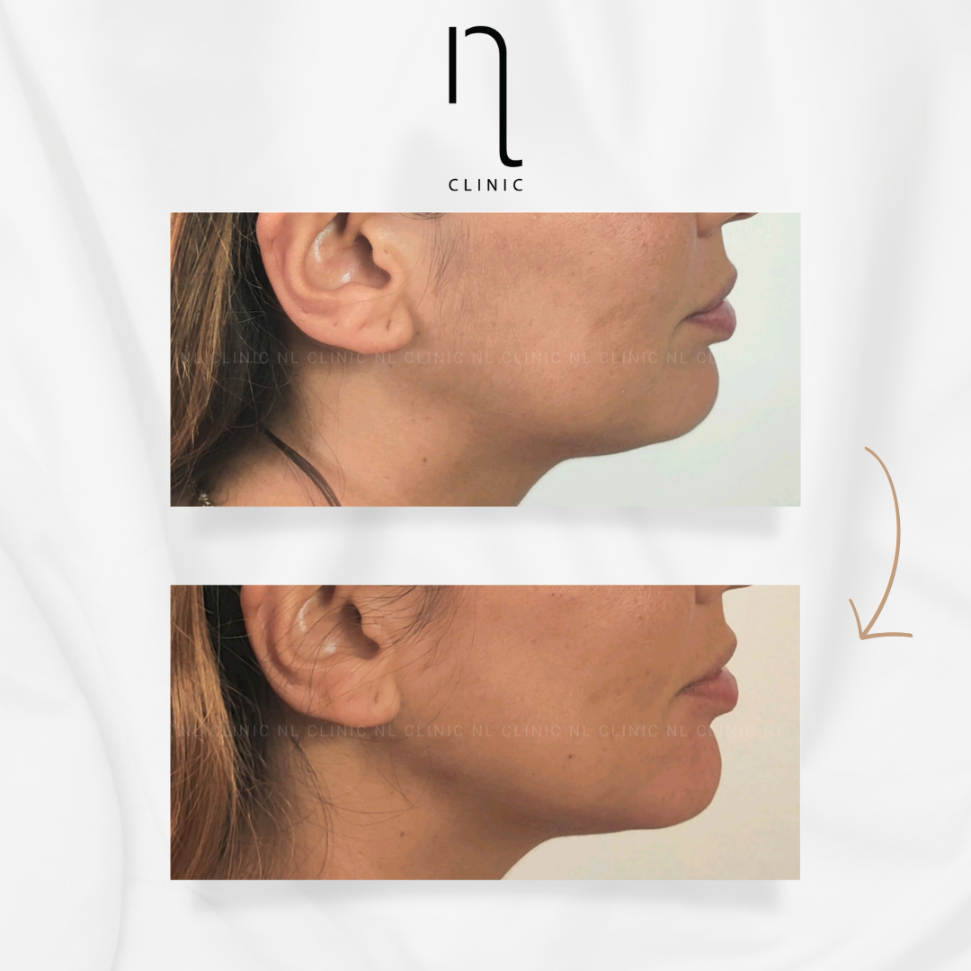 68.png