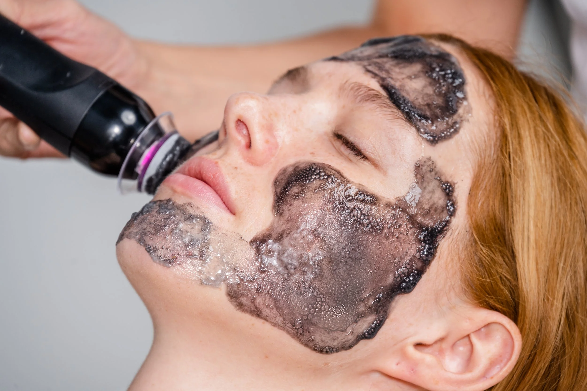 A woman with a facial mask being cleaned off with a handheld device during a skincare treatment.