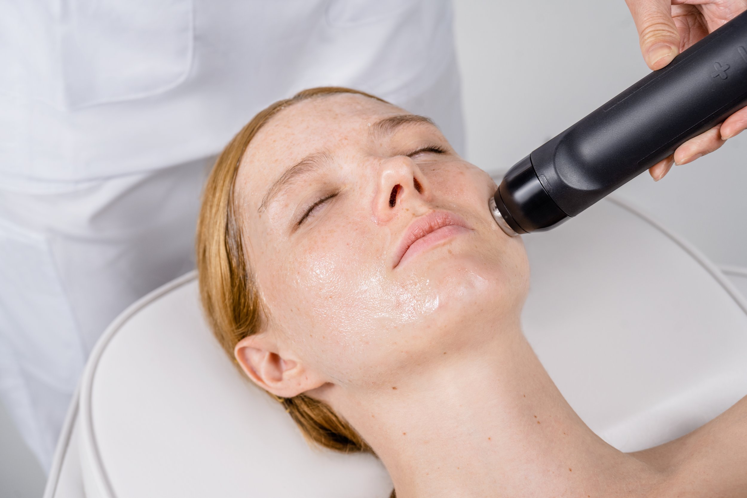A woman lying down with her eyes closed, receiving a skin treatment using a black handheld device on her cheek. The woman has light skin and reddish hair, and the setting appears to be a clinical or skincare clinic environment.