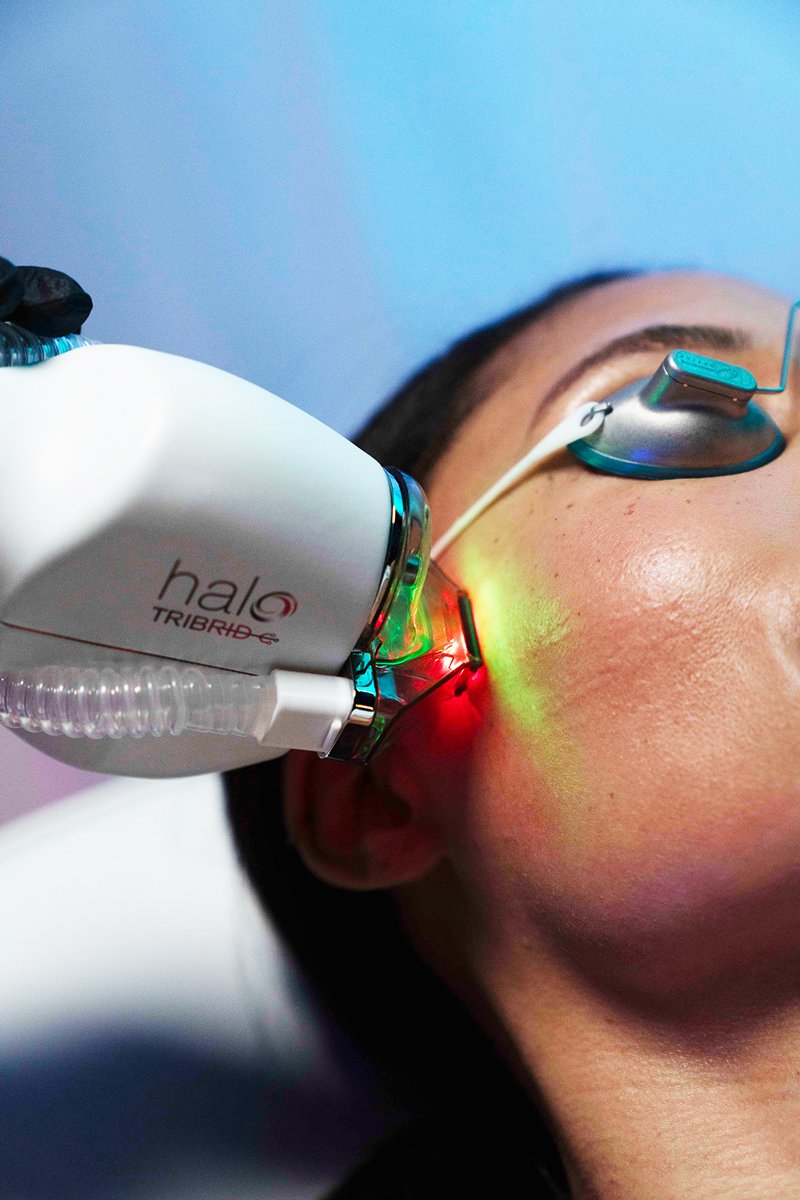 HALO Sciton Tribrid at Revive Palmetto Aesthetics & Plastic Surgery in Bluffton, South Carolina