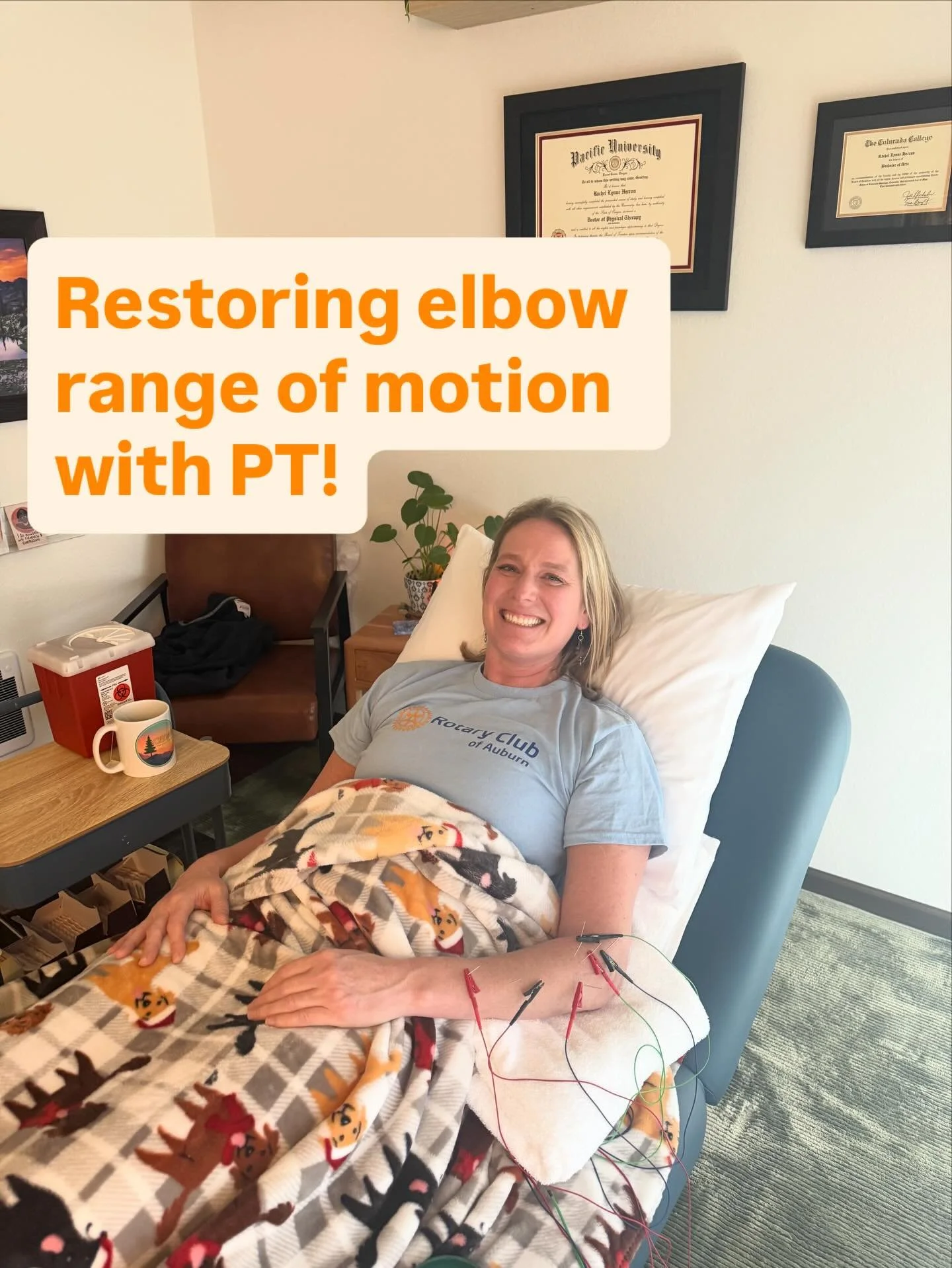Combo of dry needling + joint mobs and exercises can be exactly what the elbow needs to restore range of motion 😎✌️🏋🏾&zwj;♂️

#physicaltherapy #dryneedling #reki #holistic #wellness 

***

Disclaimer: the information shared is for educational purp