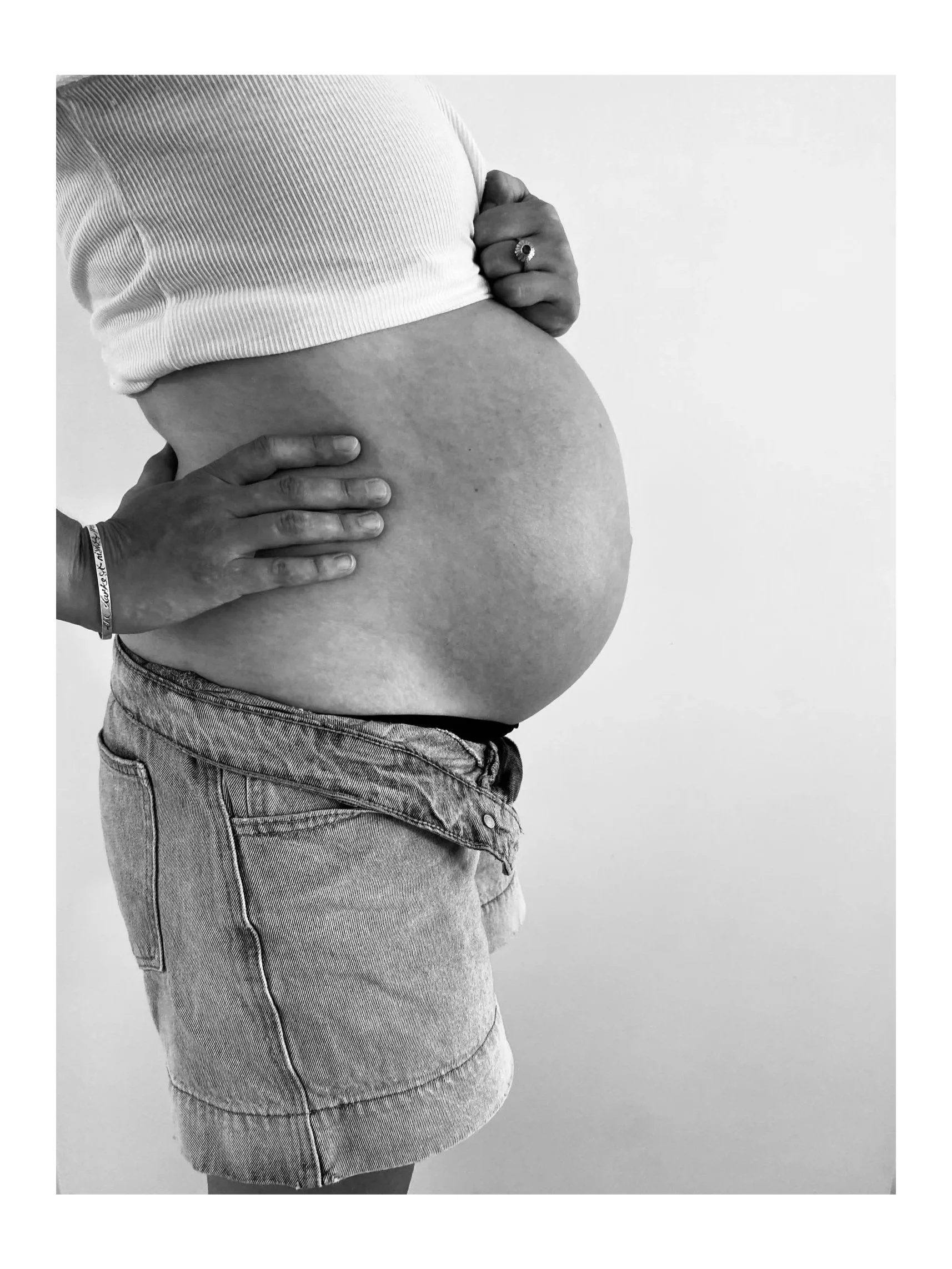 Pelvic Girdle Pain in Pregnancy.