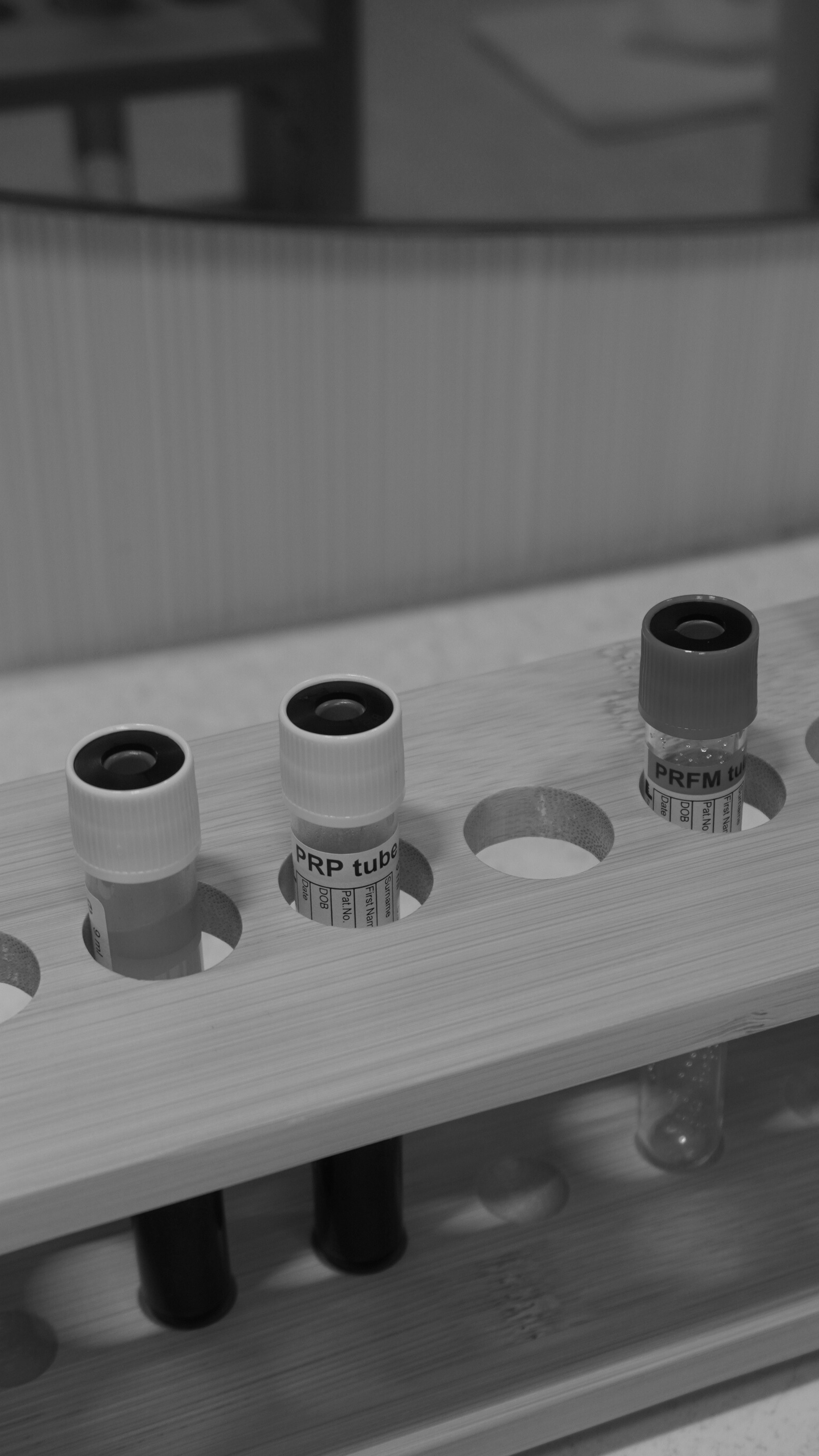 Close-up of three test tubes labeled 'PRP tube' inserted into a wooden test tube holder, with a blurred background.