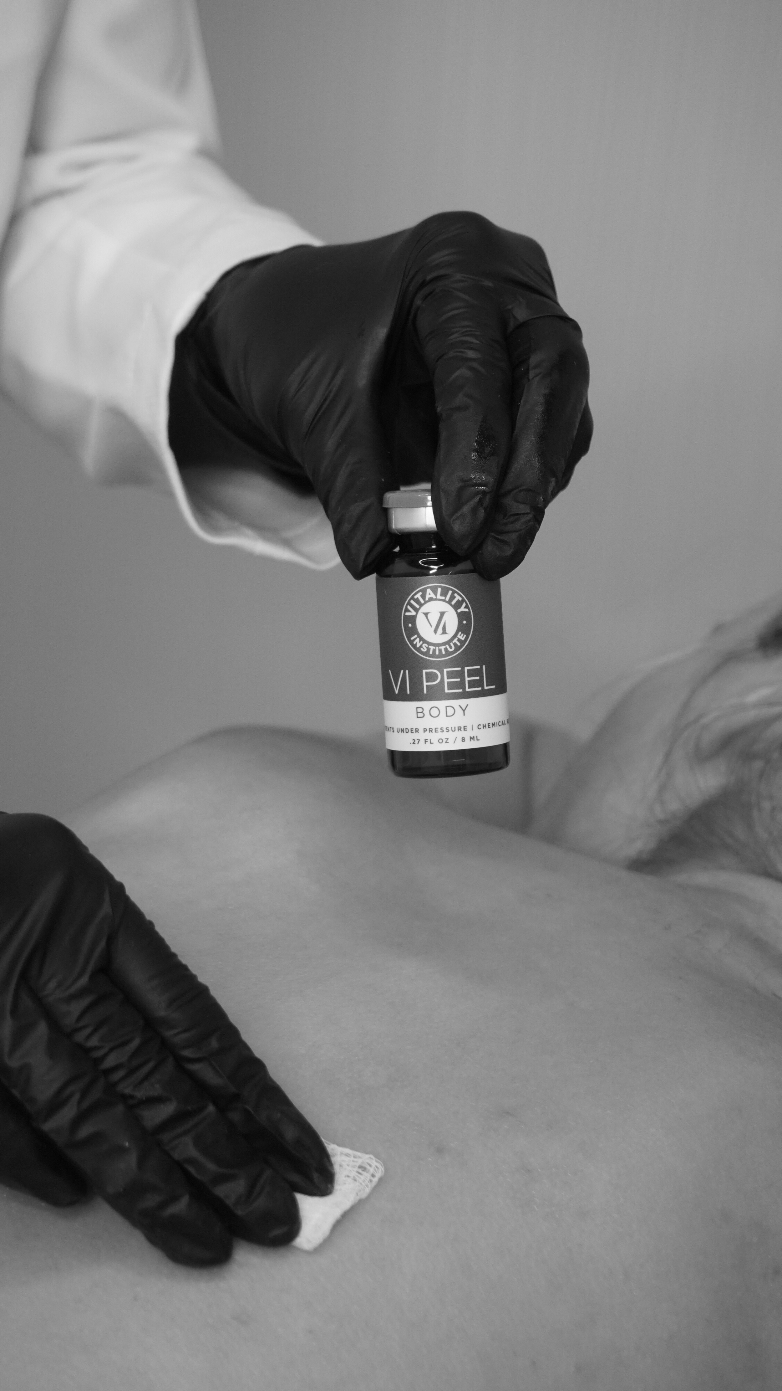 A person wearing black gloves and a white coat holding a bottle labeled 'VI Peel' over a person's chest, who is lying down during a skincare treatment.