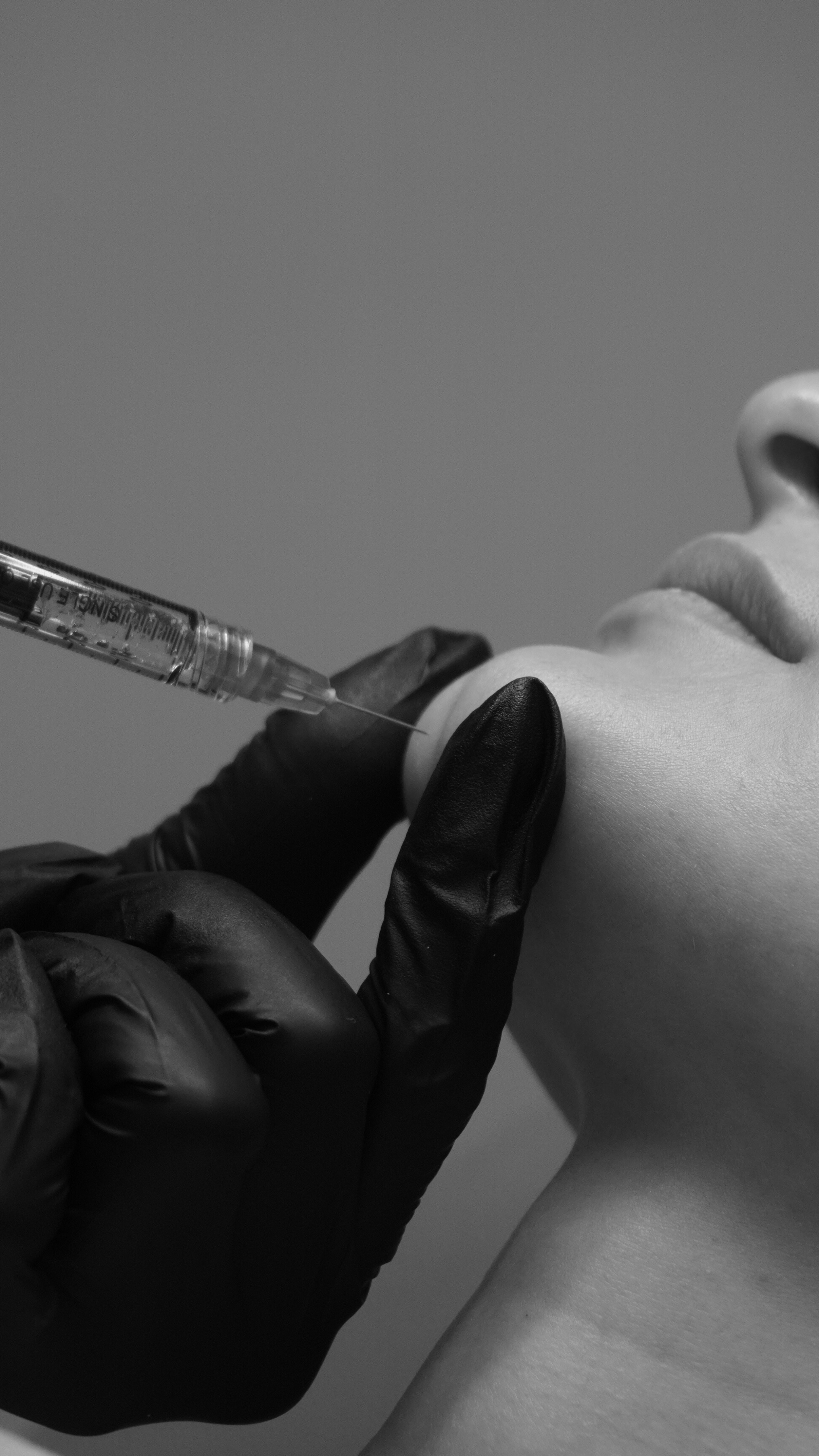 A person receiving a cosmetic injections in the lips, with a gloved hand holding the syringe.