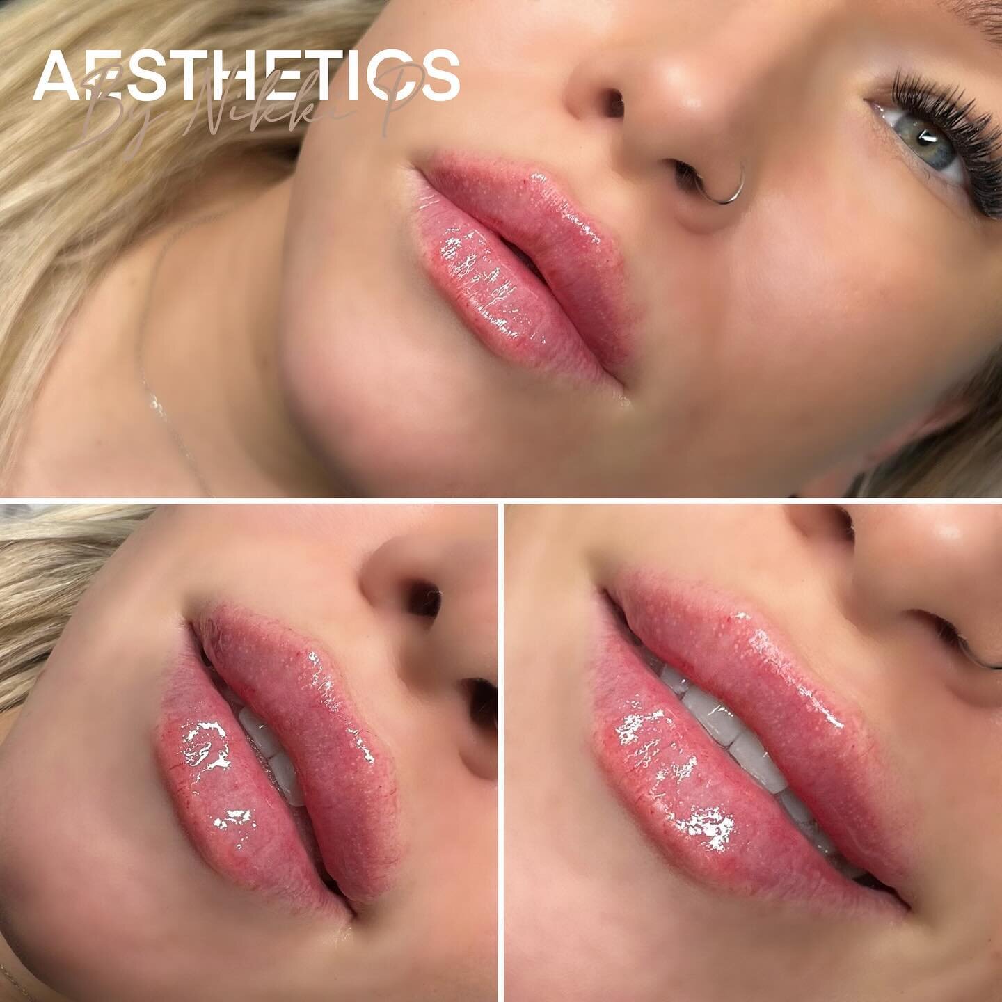 Russian lips using 0.9ml 💋❤️