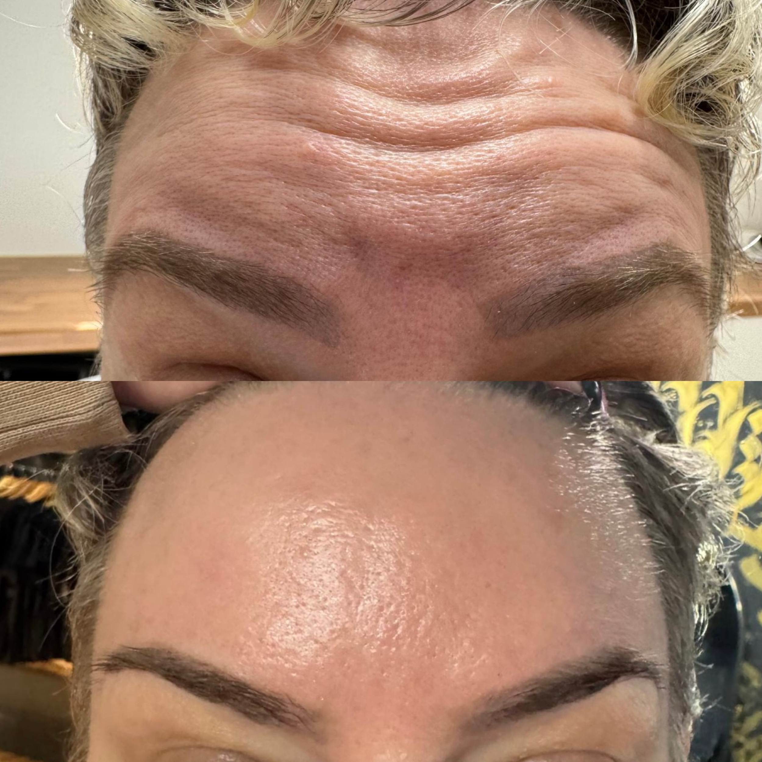 anti wrinkle 2.png