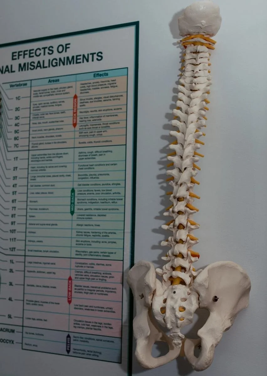 "Effects of Spinal Misalignments" anatomy chart with full spine and pelvis model in the Solana Beach office — chiropractic care for Rancho Santa Fe patients