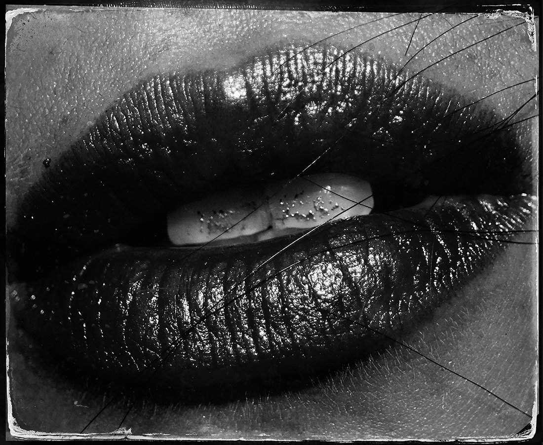 Bruised Lips