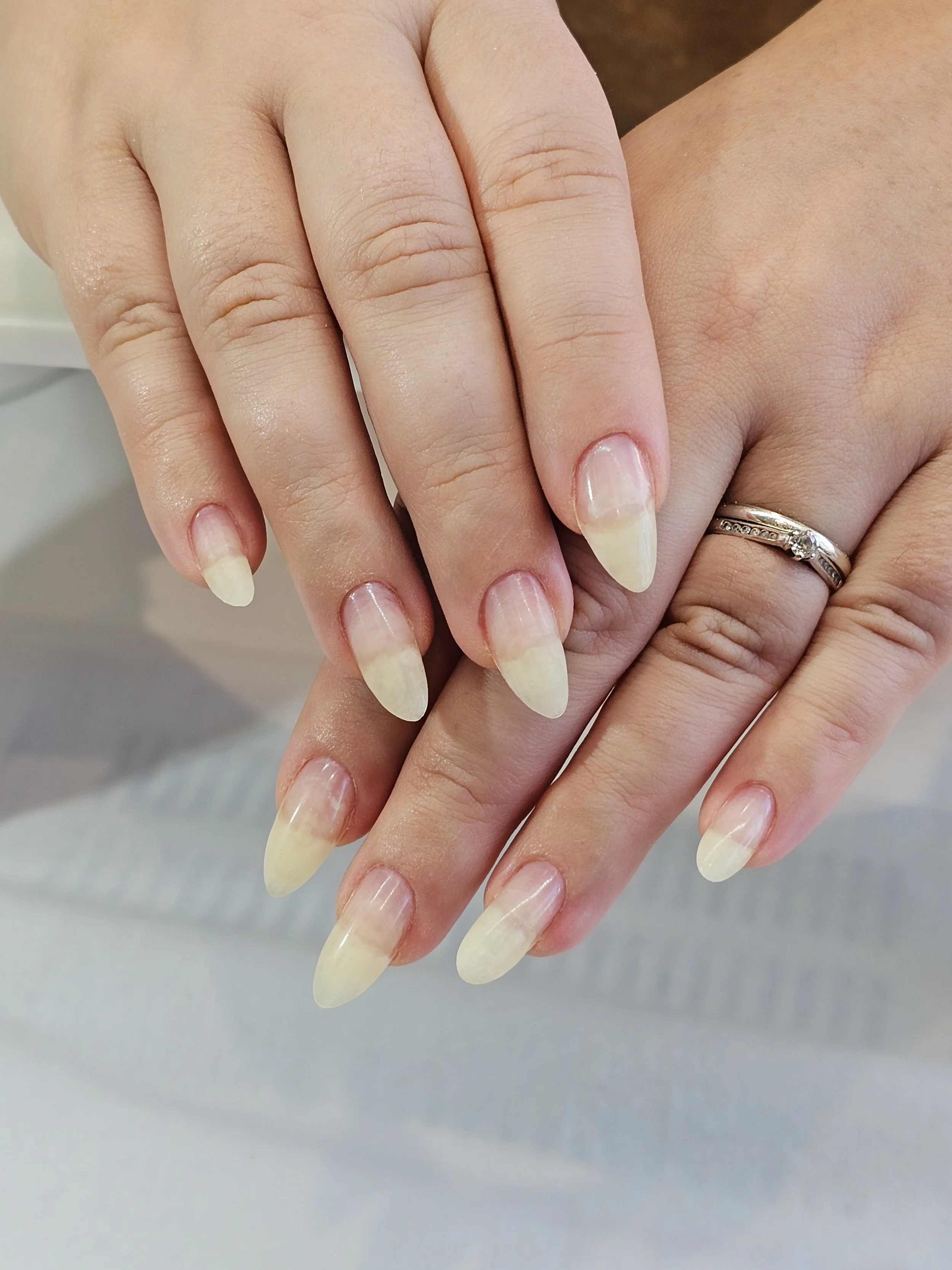 3. Client's natural nails 4.5 months in to regular treatments focusing on correcting nail structure and growth