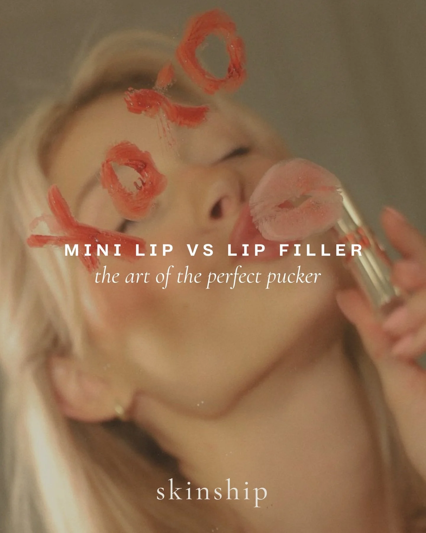 Your lips, your love language. Subtle or statement, both can be beautiful.

A mini lip adds hydration. Lip filler builds shape, structure, and volume. Customization is always the goal.