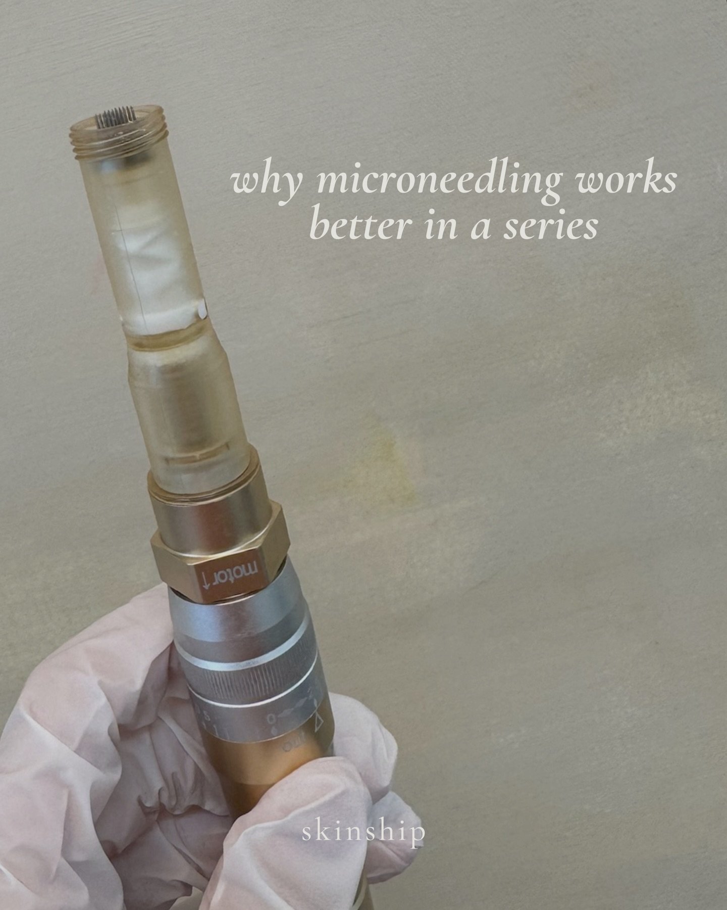 How to get the most out of your microneedling treatments 🤍