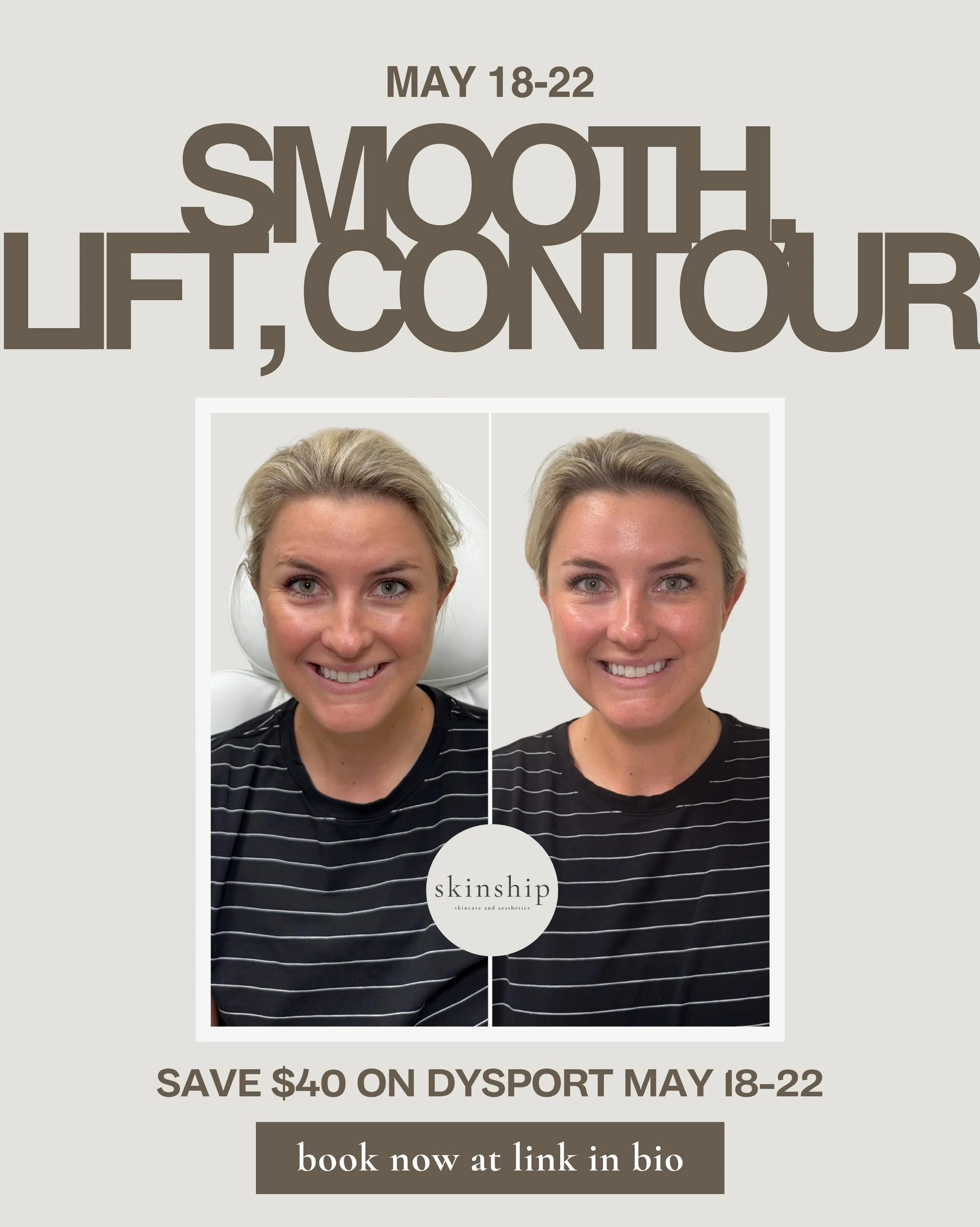 PSA: our Dysport promo is officially live!

Dysport can make a subtle but impactful difference &mdash; smoother, more refreshed, and still completely natural-looking.

THIS WEEK ONLY (May 18-22), book a Dysport appointment and receive $40 off your tr