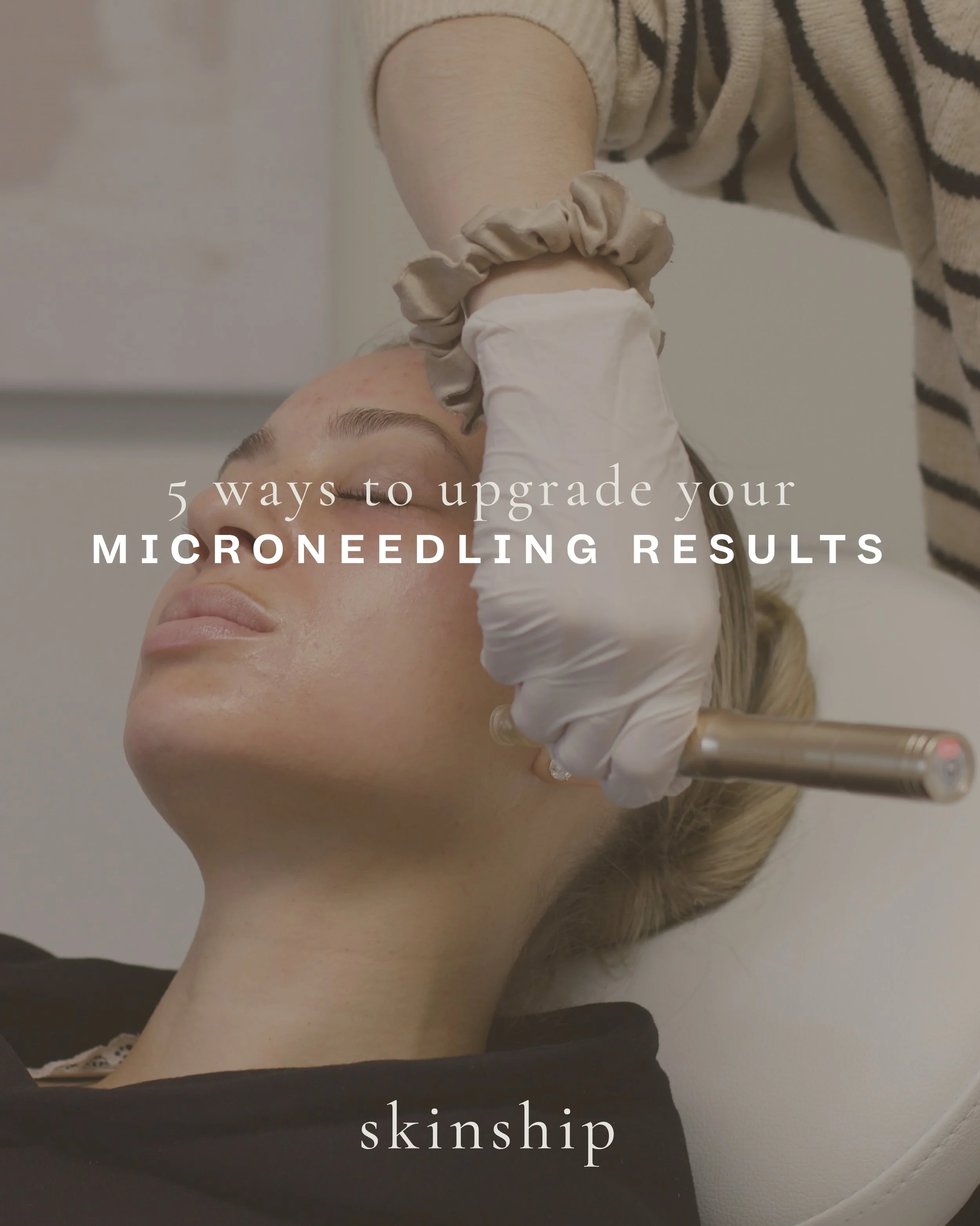 Microneedling is just the beginning.

The real magic happens when we customize your treatment to your skin.