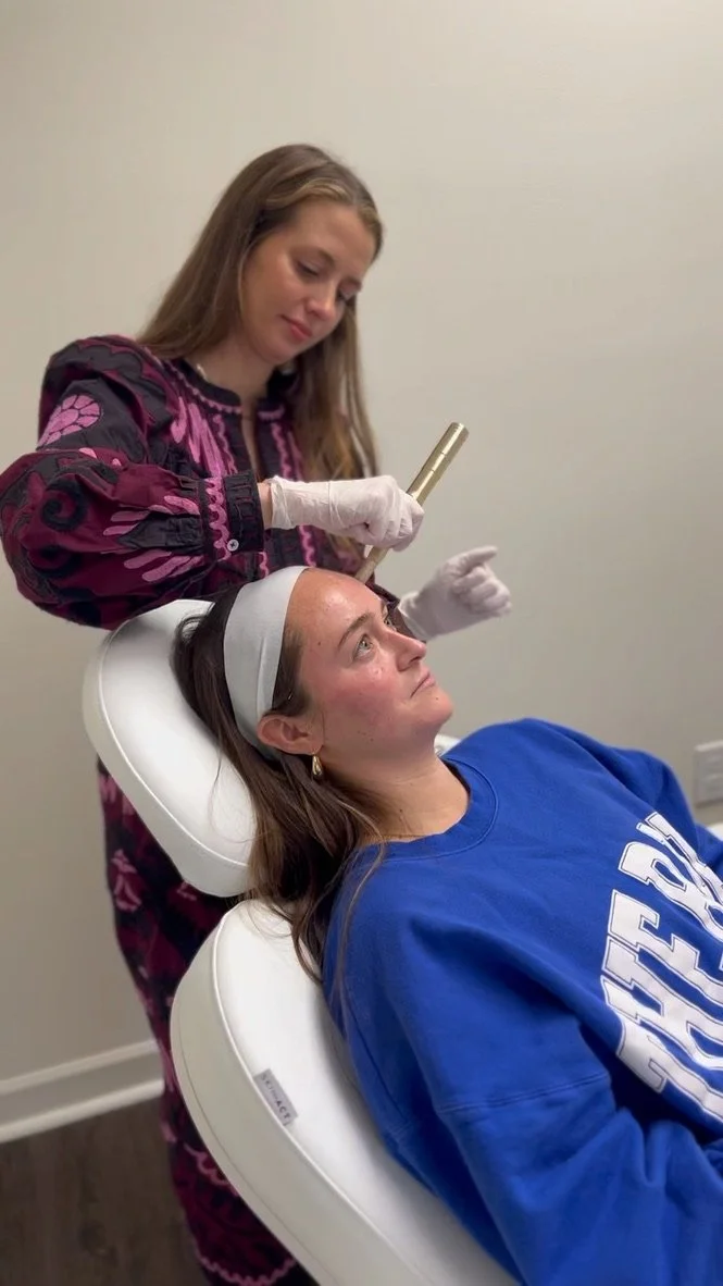 micro needling at skinship in buckhead ga