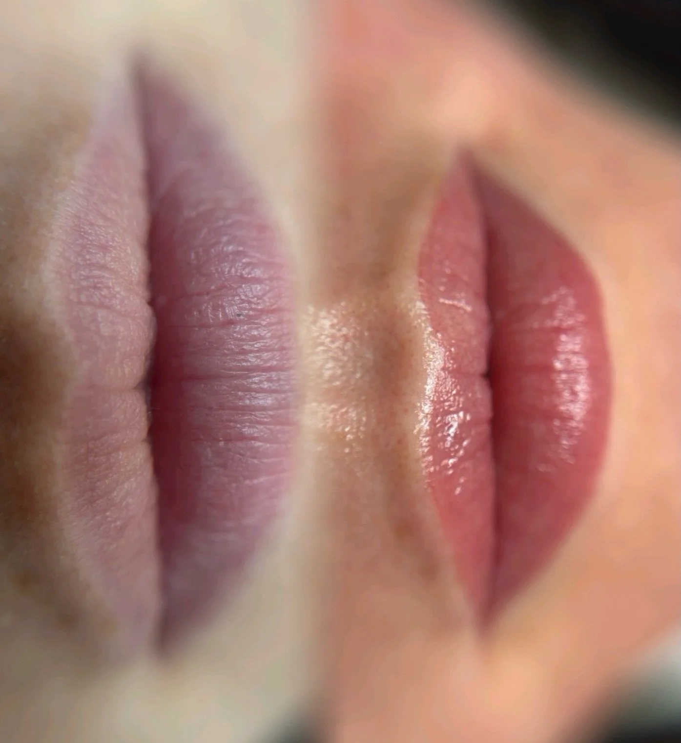 Lip blush is one of the most natural ways to enhance your lips&mdash;no filler needed. 💋

This treatment softly deposits pigment into the lips to:
&bull; Add shape and definition
&bull; Even out tone (especially if you have darker or patchy areas)
&
