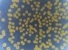 2-Hour Bacteria Identification & Quantification Assay