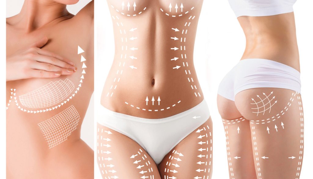 What-is-Body-Contouring-Surgery-1024x585.jpg
