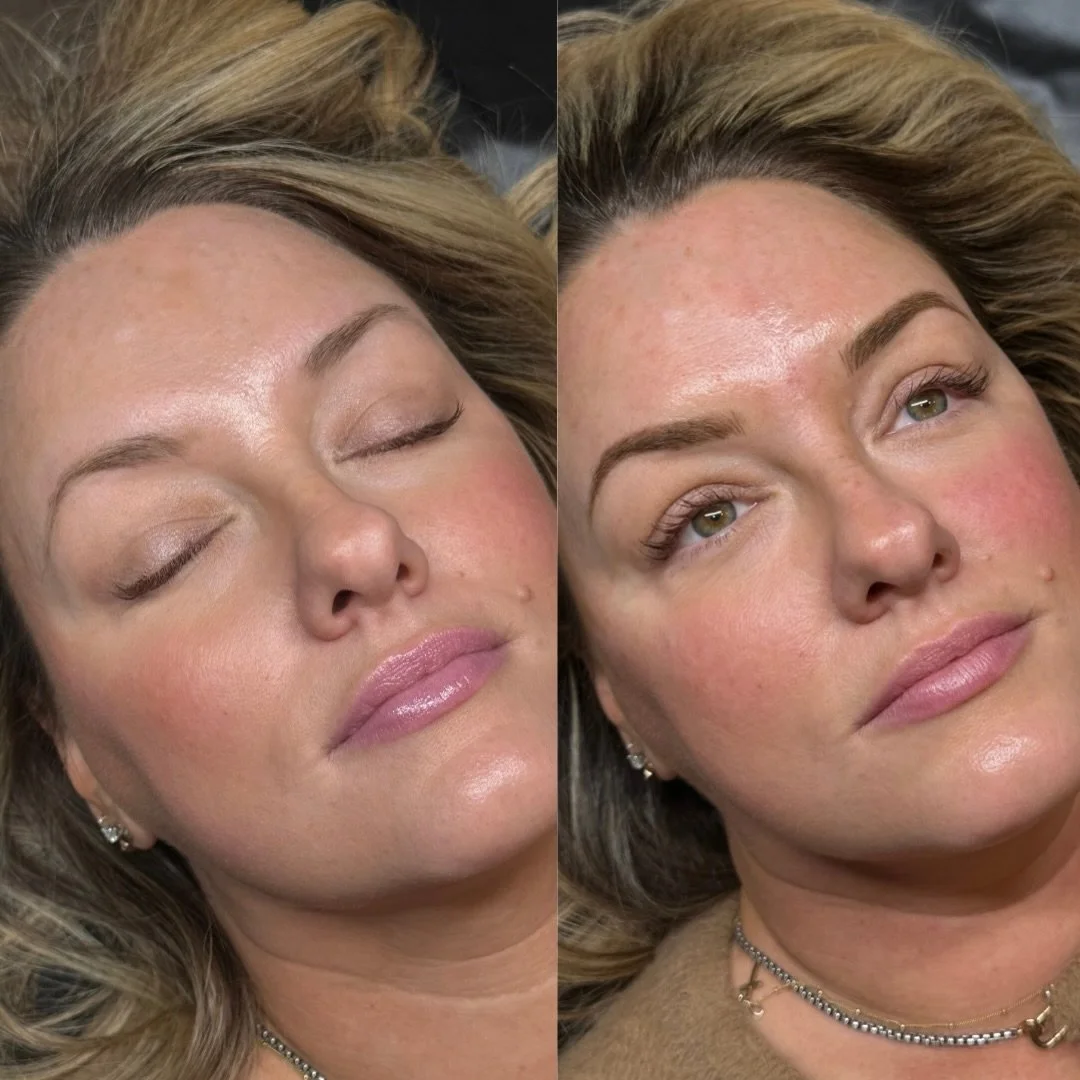 Summer ready with brows that don&rsquo;t budge ☀️
Save time every morning, skip the brow pencil, and enjoy sweat-proof, smudge-free brows all day
Combo brows = less work, more confidence
This technique can last 2-3 years and heals into a soft shadow 