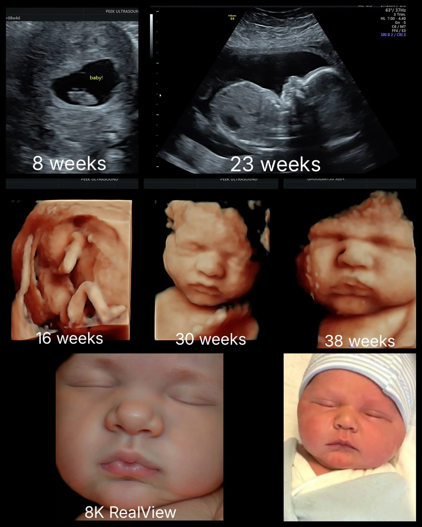 some babies i meet once, some i get to follow from first heartbeats all the way to birth 🥰 

this little boy is so loved by the sweetest parents! i&rsquo;m so lucky to have had the privilege of watching him grow alongside you, Brittany 🩵

#itsaboy 