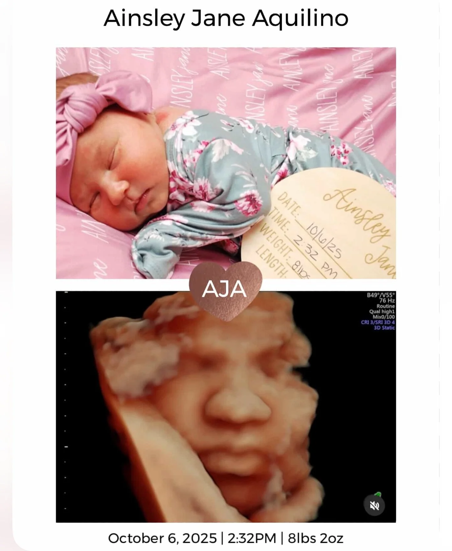 a big warm earthside welcome to beautiful baby Ainsley Jane 🌸🩰✨ thank you Victoria for sharing this sweet girl with me throughout your pregnancy! hope you&rsquo;re soaking up alllll those newborn snuggles 😌☁️

book your private sono today at www.p