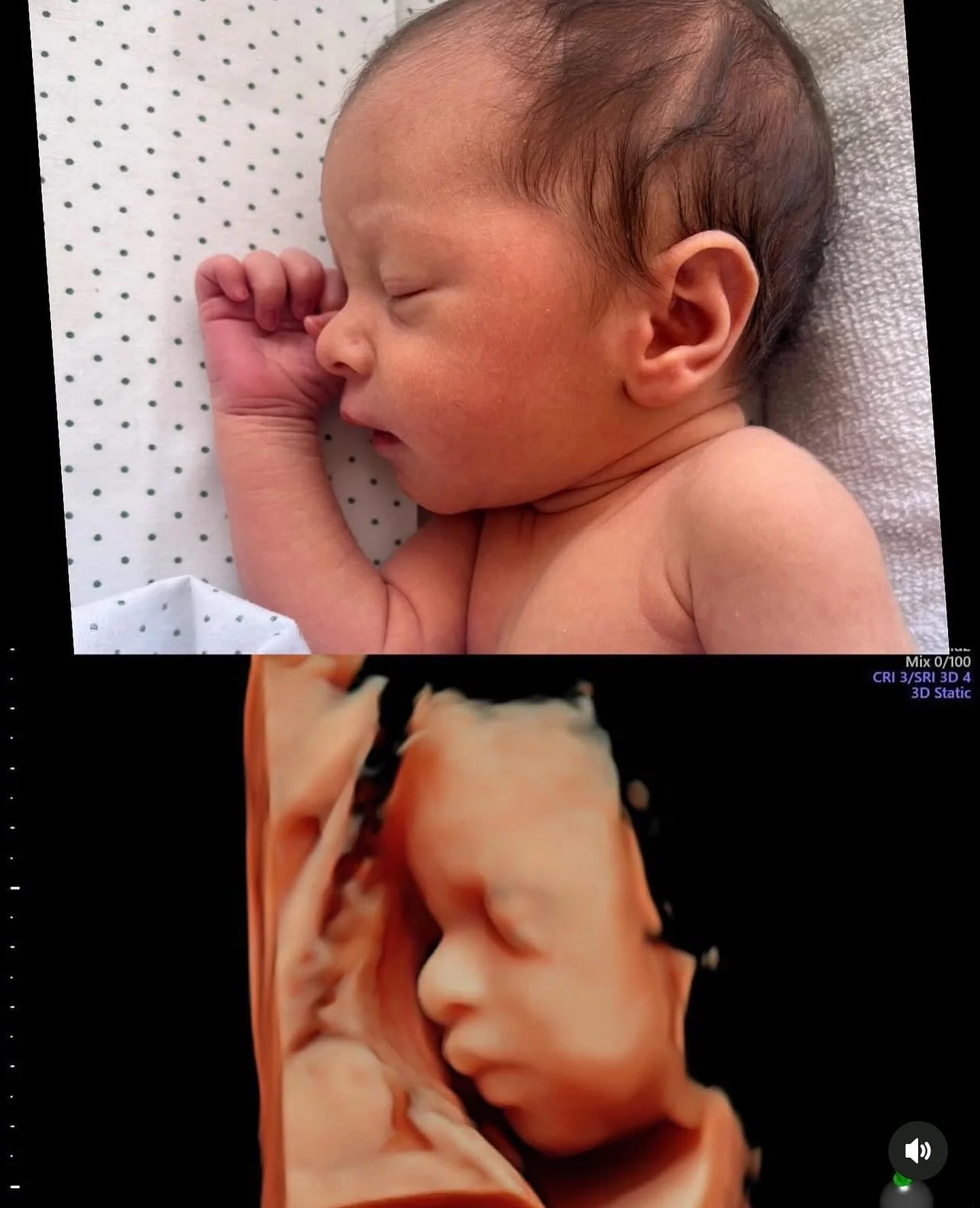 the sweetest proof that those little features you see in 3D are already so perfectly them 🤍 baby boy&rsquo;s side profile in the womb looks just like his newborn photo! book your session today to capture your little one before they arrive ✨

#3dultr