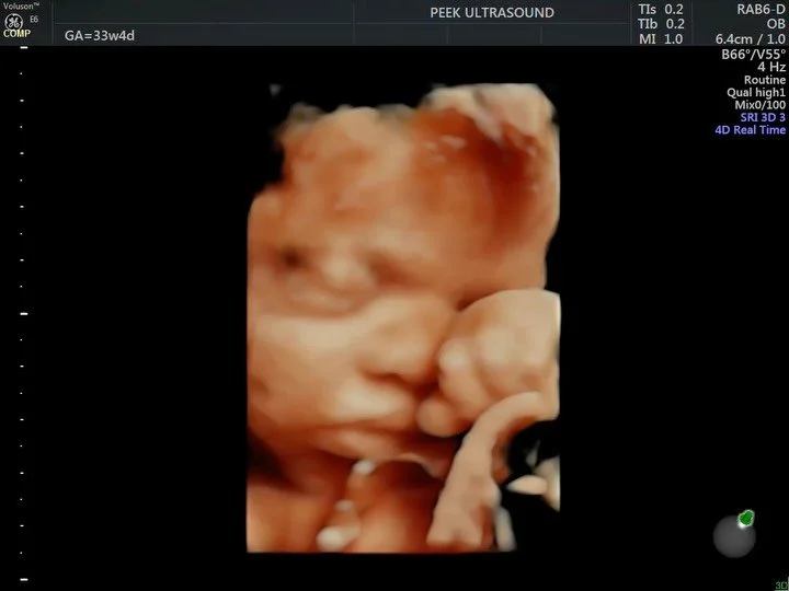 surprise gender pregnancies are always so fun to scan! 🤩❔this little one spent their session smiling, stretching, and looking for a thumb to suck 👍🏼 

with all the attitude and eye rolling, we were getting girl vibes the whole time 🙄🎀🤭💅🏼 what