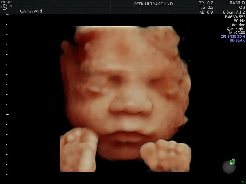 Madison Rae 🩷 ✨

this cutie spent the whole ultrasound showing off her tiny feet! 👣 an entertainer from the very beginning 🎀💅🏼

book your february session online today! 

#babygirl #ultrasound  #sonographer #obgyn #pregnancyjourney