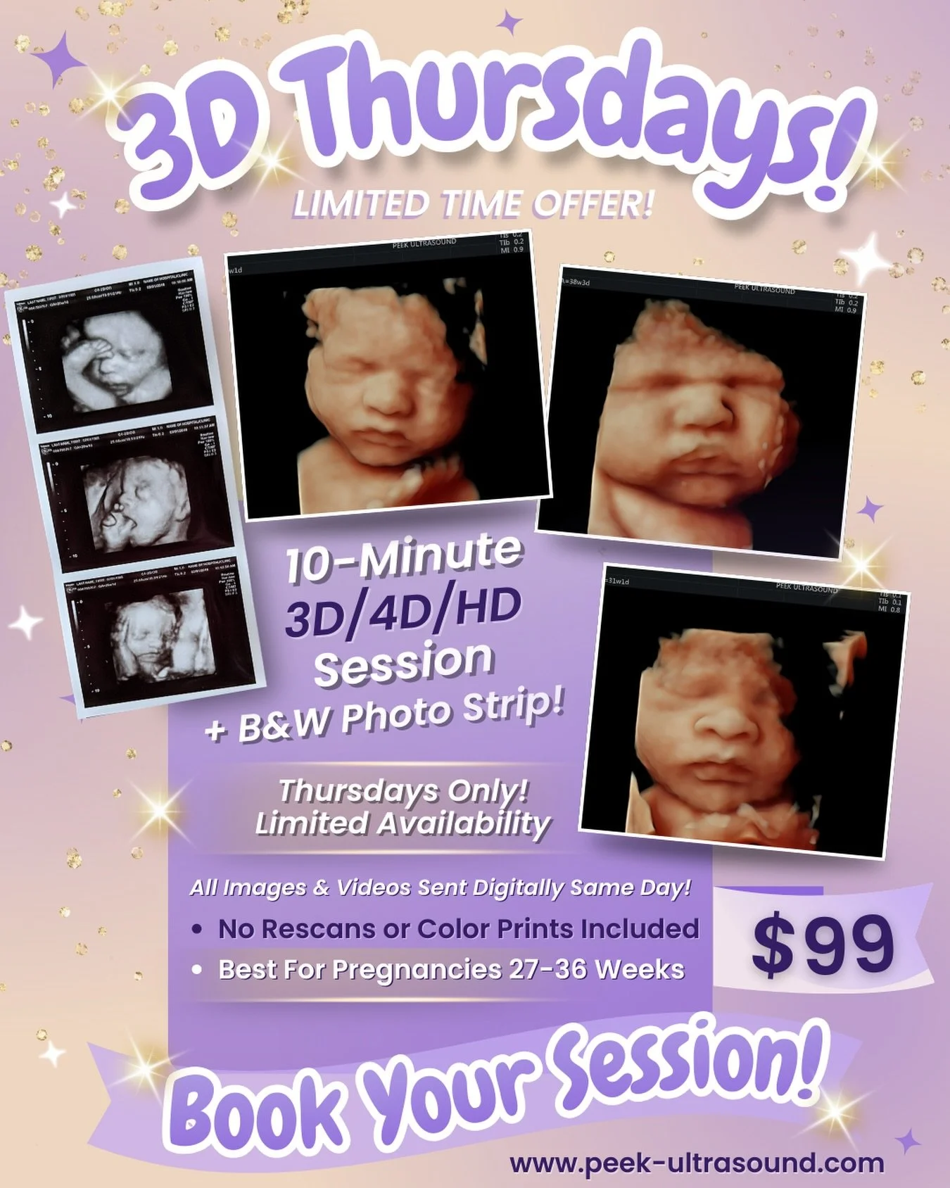 ✨ 3D Thursdays are here! ✨

For a limited time, enjoy a 10-minute 3D/4D/HD ultrasound + B&amp;W photo strip for just $99 🤍

Perfect for seeing those sweet little features up close on the face you&rsquo;ve been dreaming of 🥹💜

👶🏼 Thursdays only |