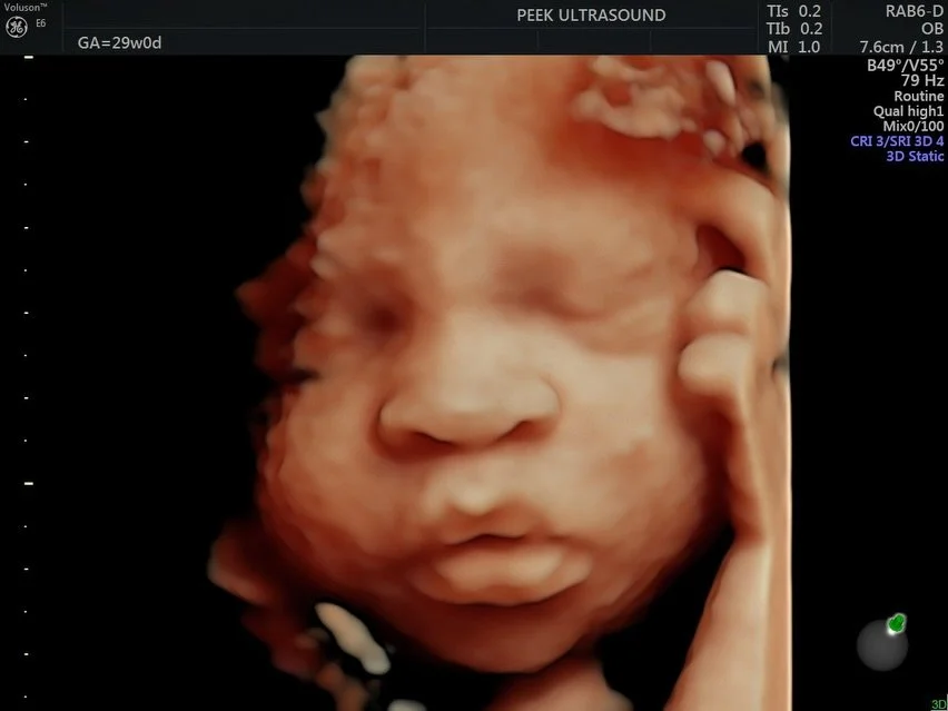 29-week baby boy due in June showing off those tiny hands and perfect cheeks 💙

the best window for facial imaging is between 26-32 weeks, when baby has enough fat under the skin to show clear features, but still has enough room to move into great v