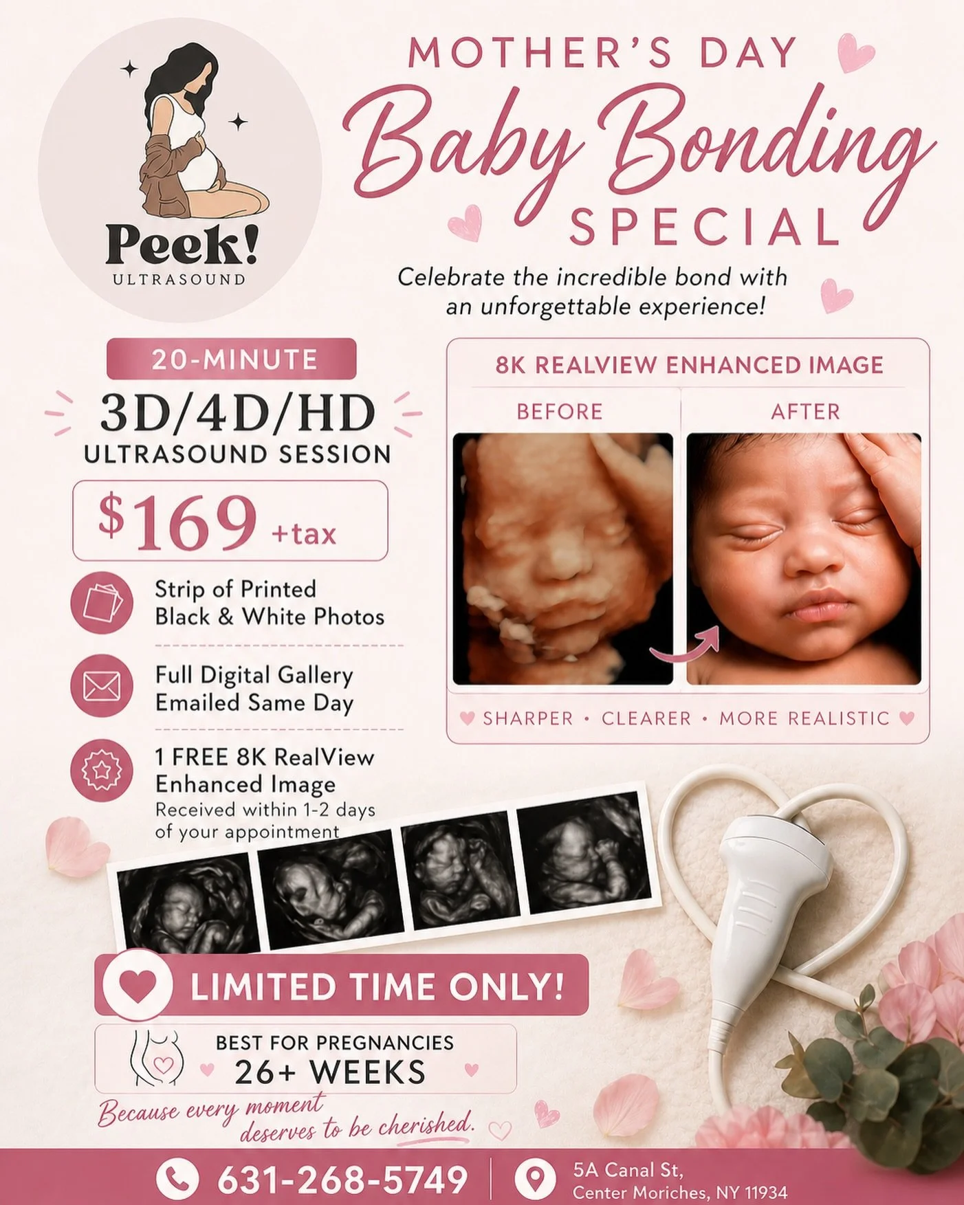 Celebrate the most beautiful bond this Mother&rsquo;s Day with Peek Ultrasound 👶🏼💐✨

There&rsquo;s nothing like seeing your baby&rsquo;s sweet face for the very first time. Our 💕 Mother&rsquo;s Day Baby Bonding Special 💕 is designed to give you 