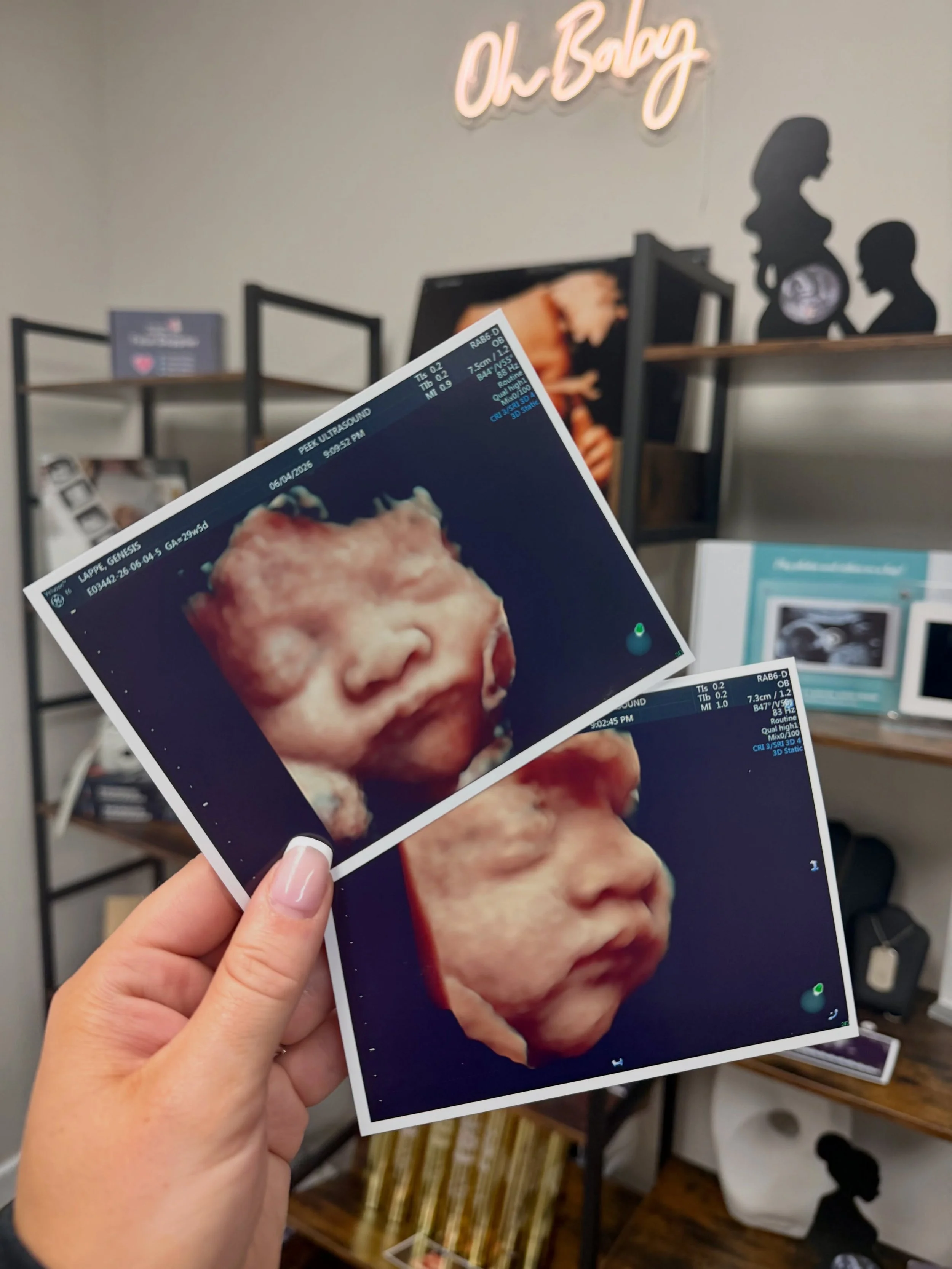 a moment for the high-definition color prints that come with all our 2nd &amp; 3rd trimester 3D scans 🤩 

we all love a classic black &amp; white ultrasound photo strip but there&rsquo;s just something so special about holding these beautiful color 