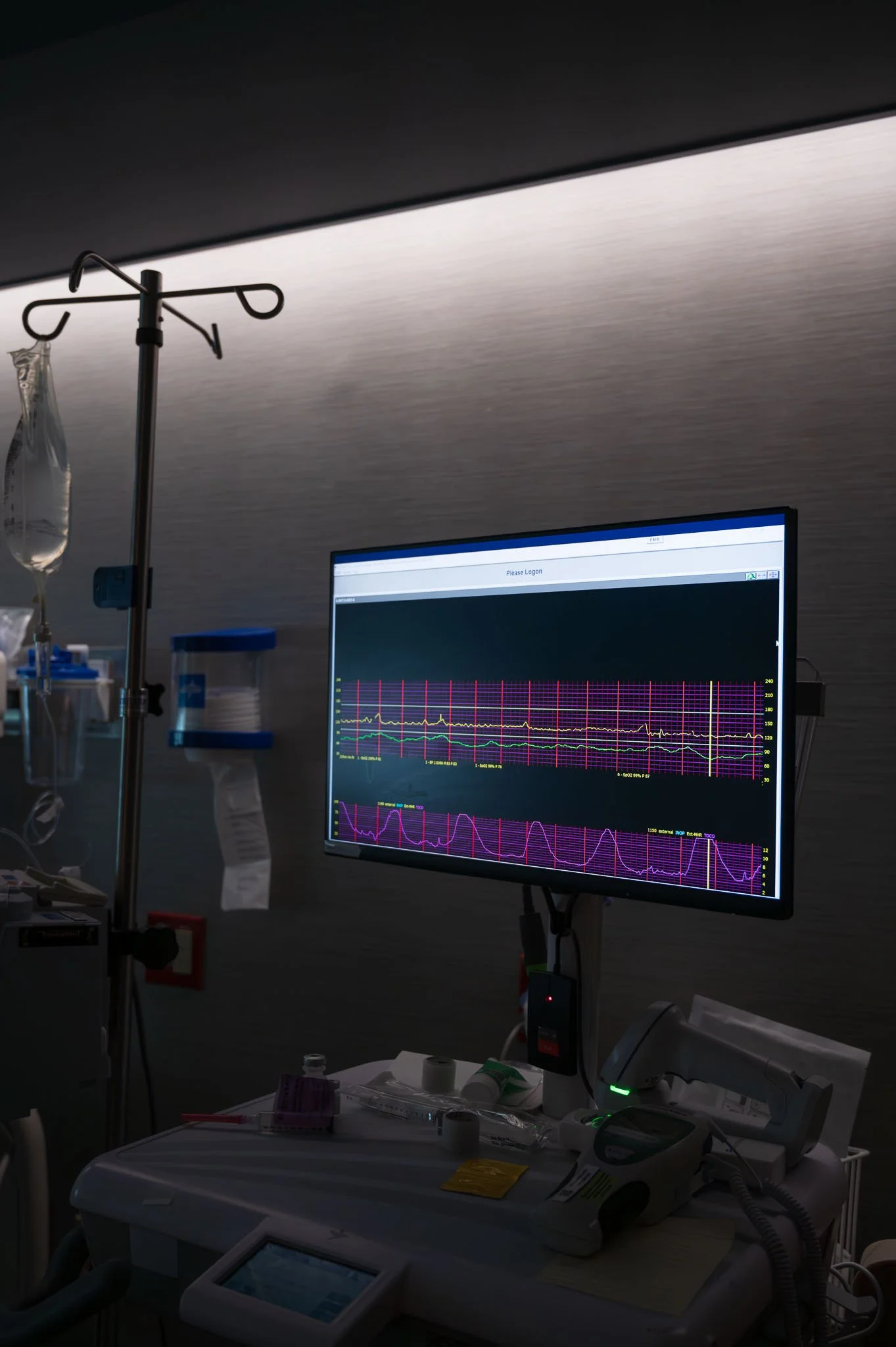 Medical monitor displaying heart rate and brain wave graphs in a hospital room with medical equipment and IV stand.