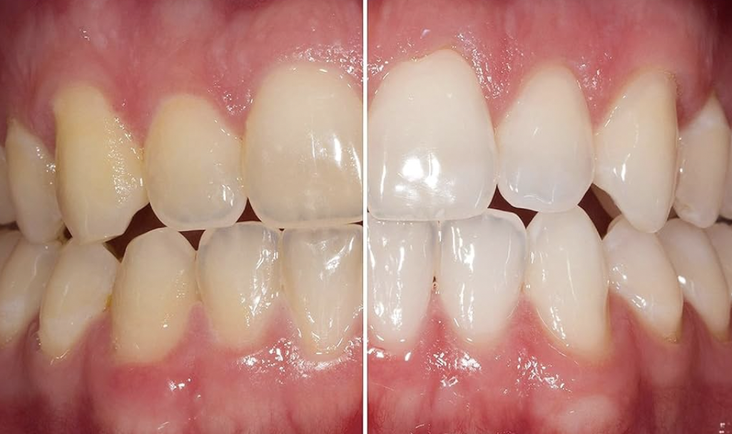 Screenshot 2024-03-09 at 9.26.40 PM.png