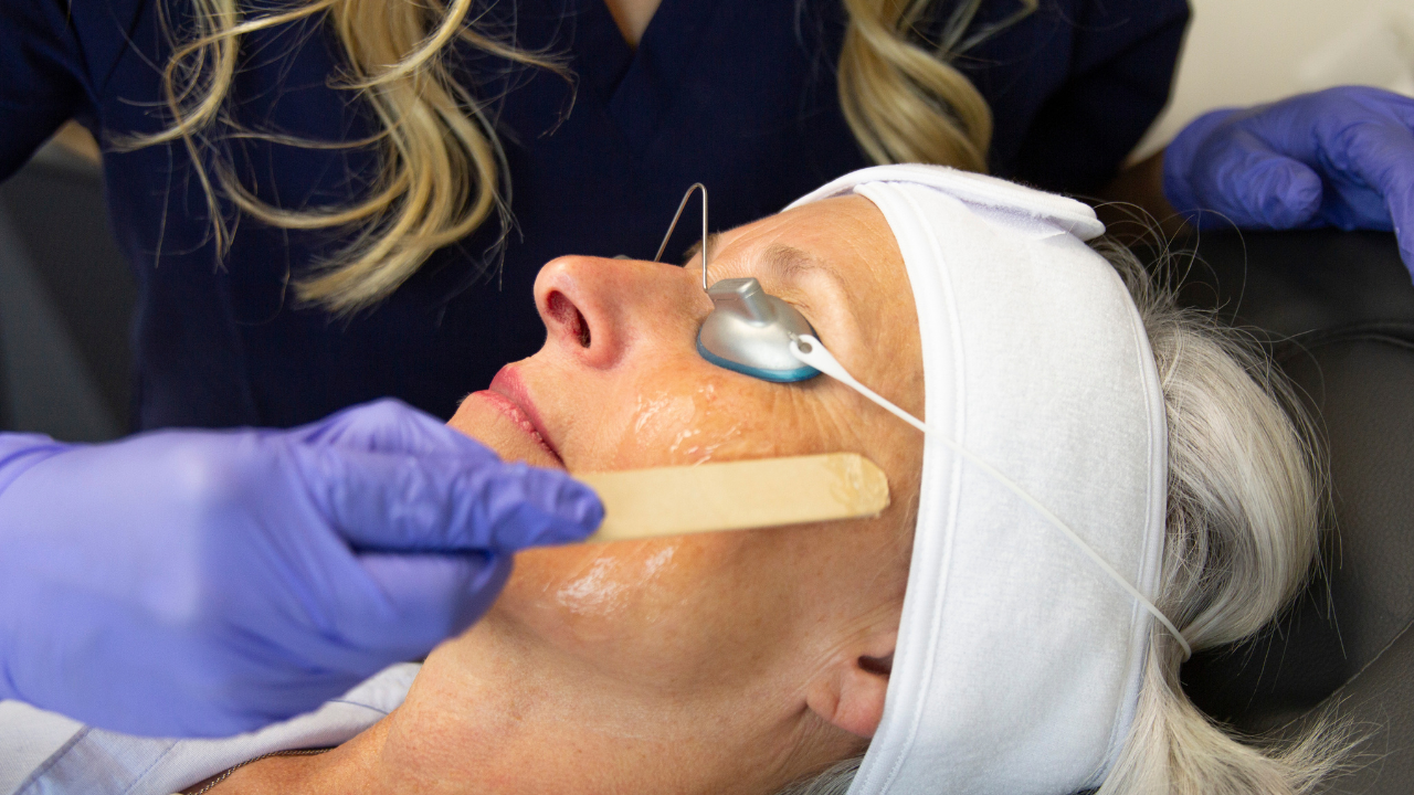 Erase Age Spots with Expert Removal in Owasso