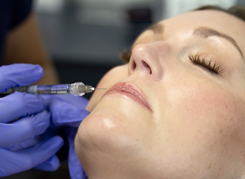 Lip Flip vs Lip Filler: Which Is Right for You?