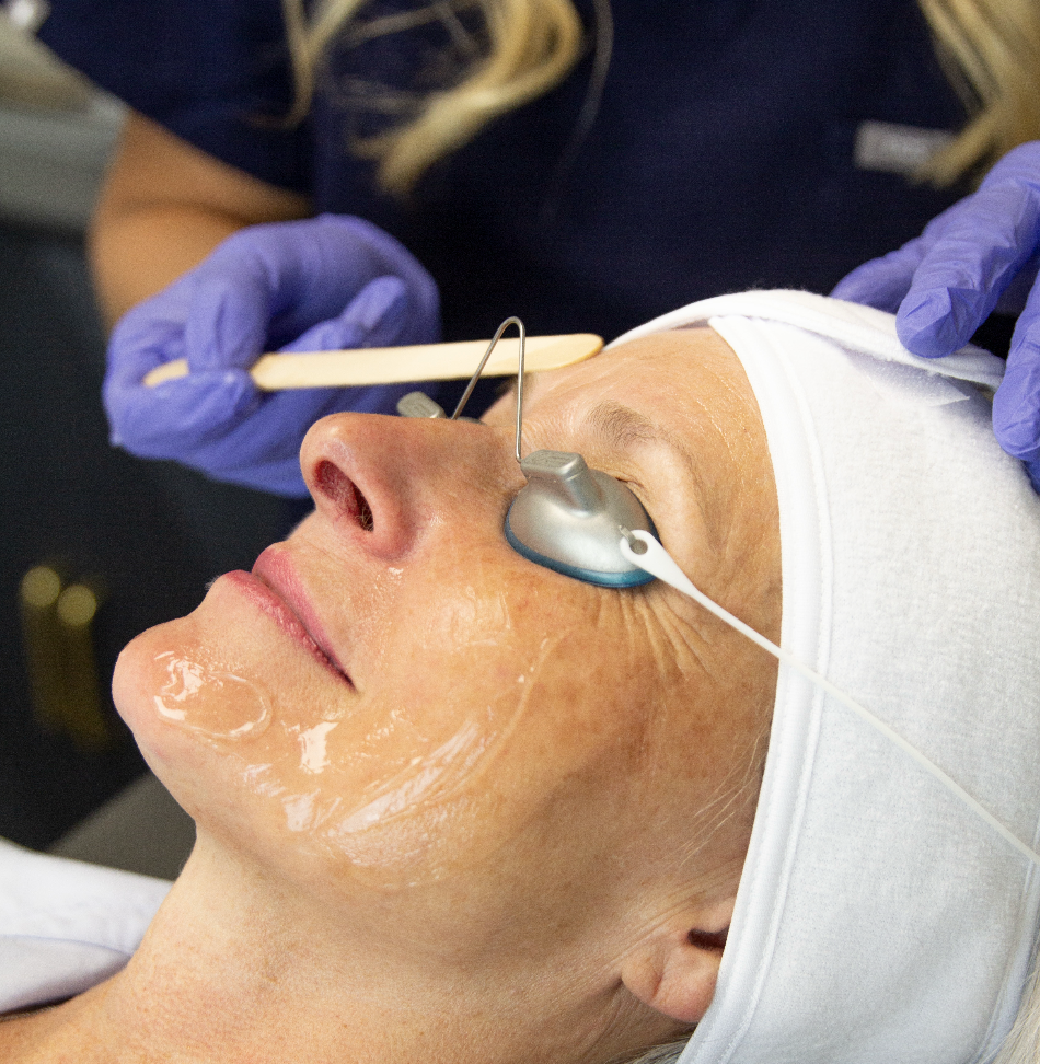 Is It Chemical Peel Season? Best Time to Resurface in Owasso