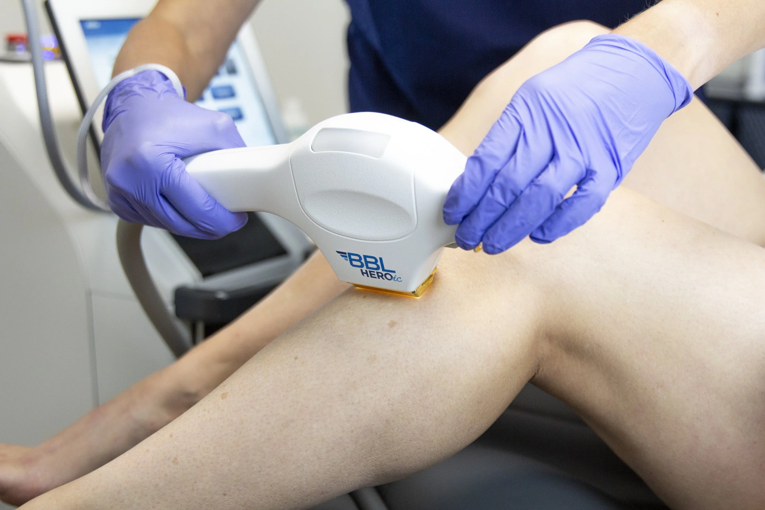 Why Fall Is the Best Time to Start Laser Hair Removal in Owasso