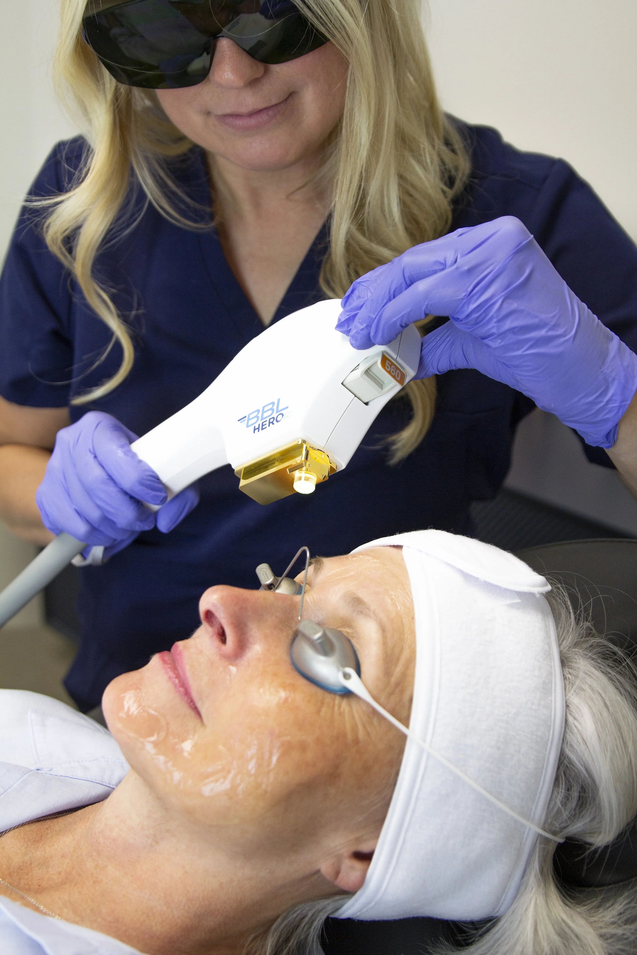 Treating Summer Sun Damage: BBL and IPL Photofacials in Owasso