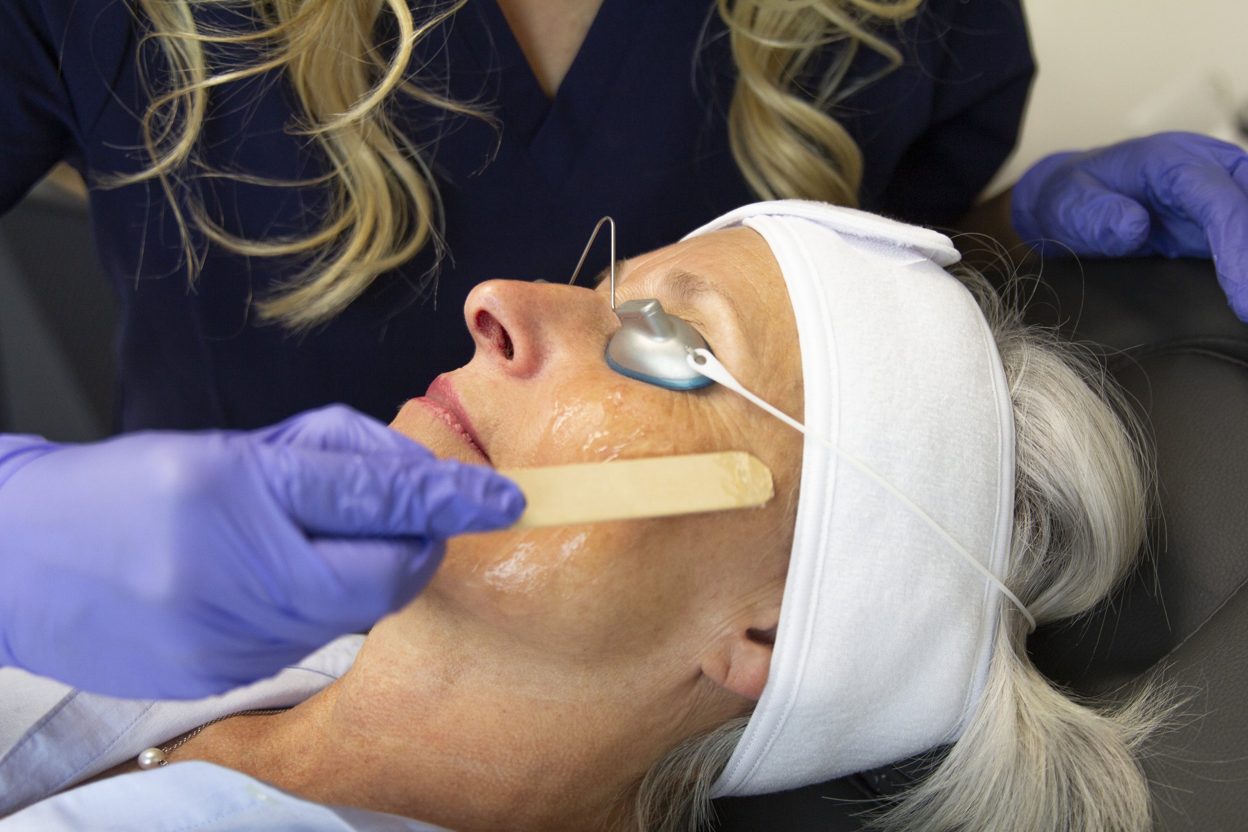 Fall Chemical Peel Recovery: What to Expect and How to Care for Your Skin