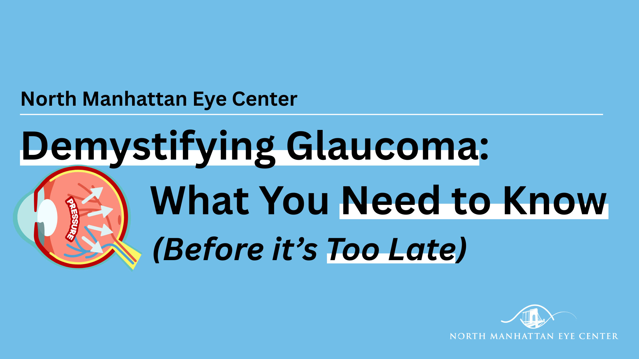 Demystifying Glaucoma: What You Need to Know (Before It’s Too Late)