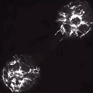 BRAIN CELLS FORMING NEW CONNECTION BY RELEASING NEUROTRANSMITTERS