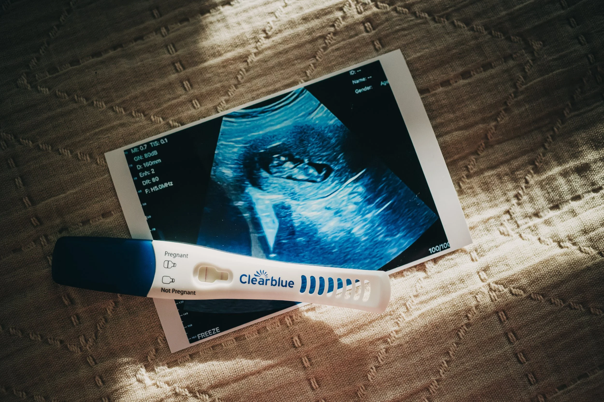 the one where I’m a “Birdie”