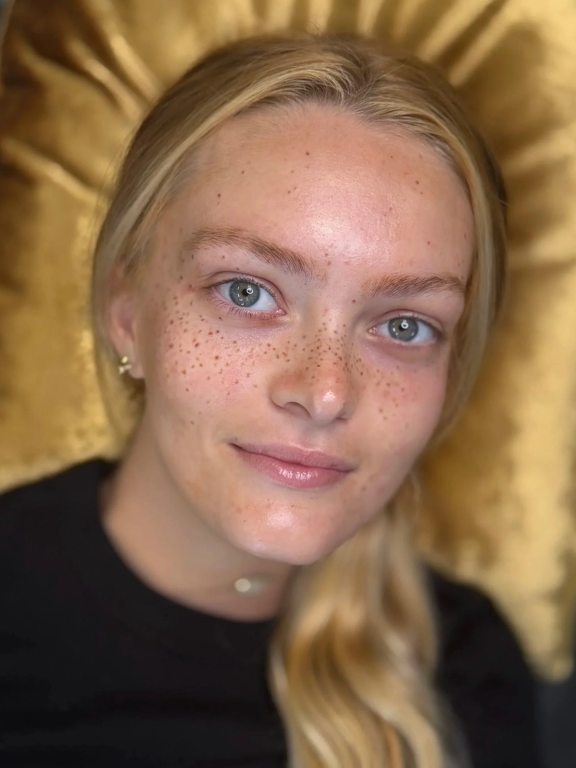 Natural-looking cosmetic freckle tattoos across the nose and cheeks by Adia Tattoo in San Diego